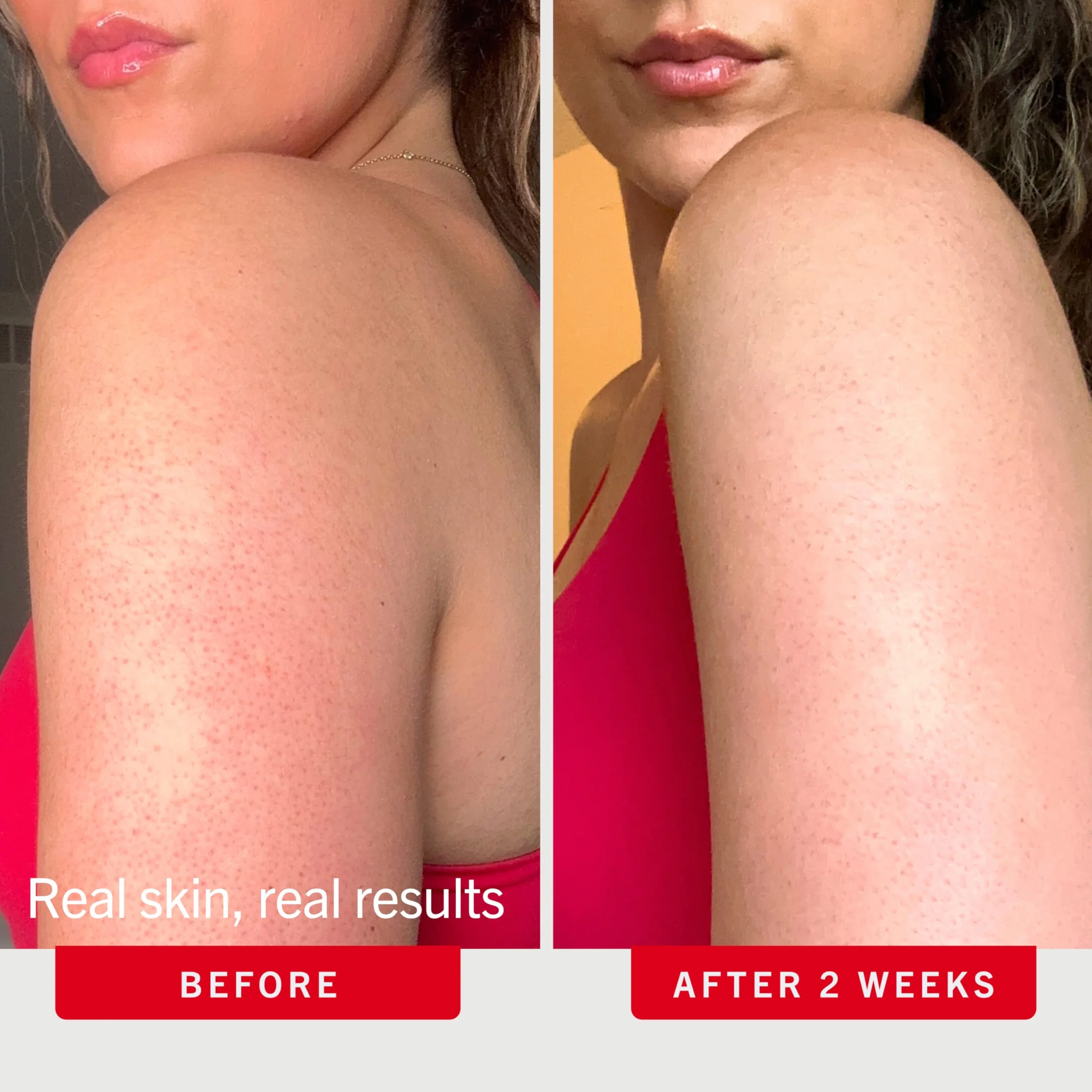 First Aid Beauty Peeling do ciała KP Bump Eraser kokosowy - 2.0 oz