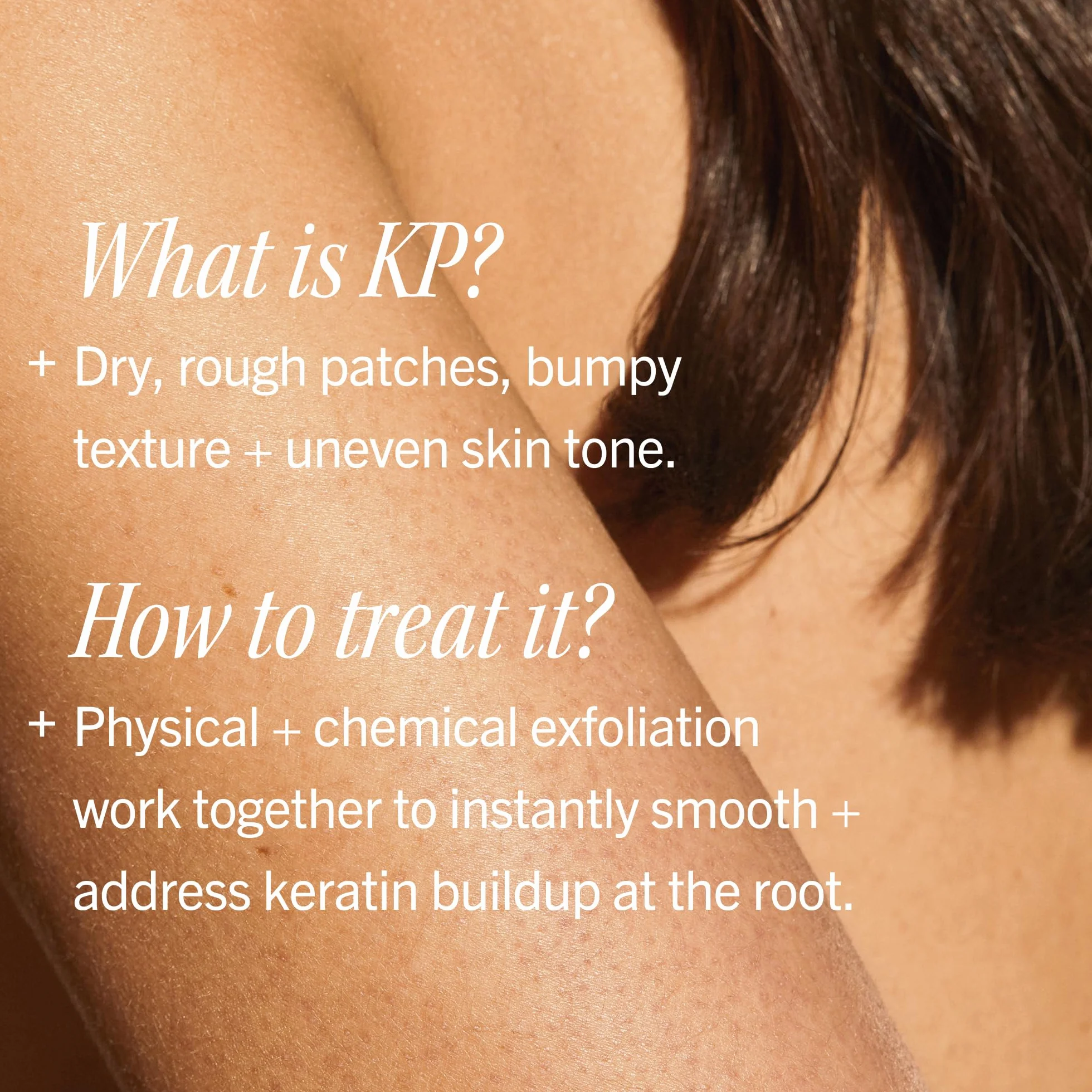 First Aid Beauty Peeling do ciała KP Bump Eraser kokosowy - 2.0 oz