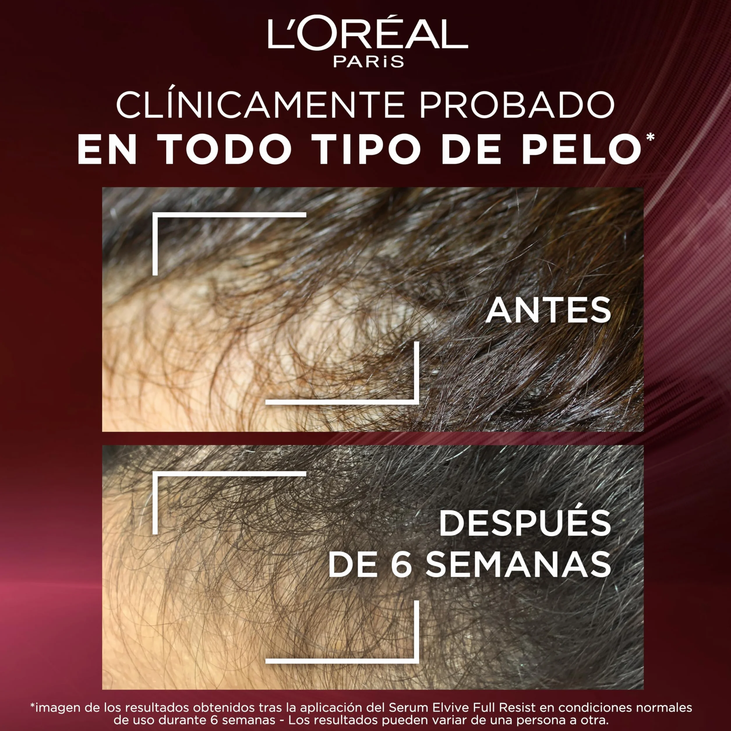 L’Oréal Paris Elvive Anti Hair Fall Serum do Włosów, 102 ml