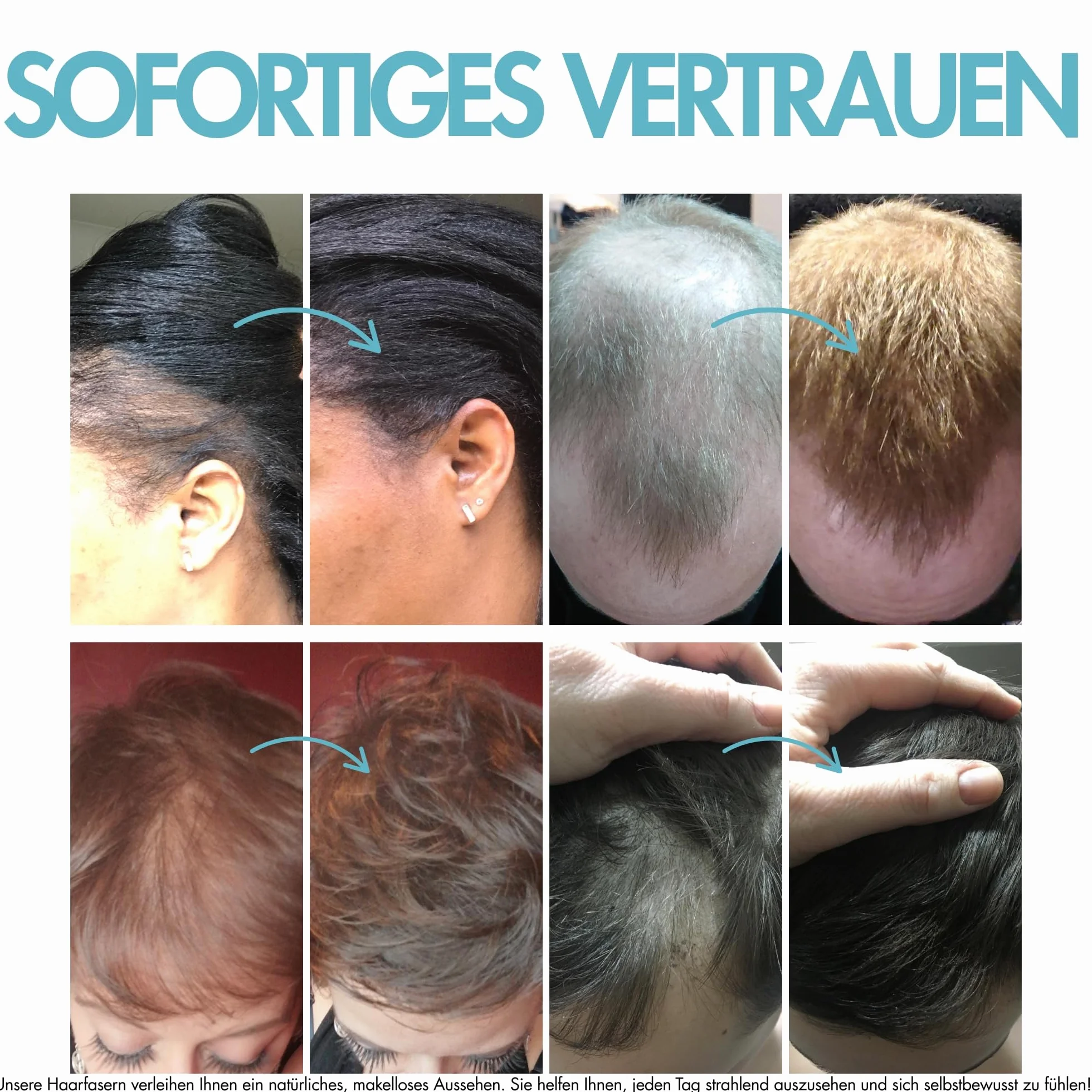 Hair Genetics Włókna włosów, na wypadanie i przerzedzanie włosów, 22 g, ciemnobrązowe
