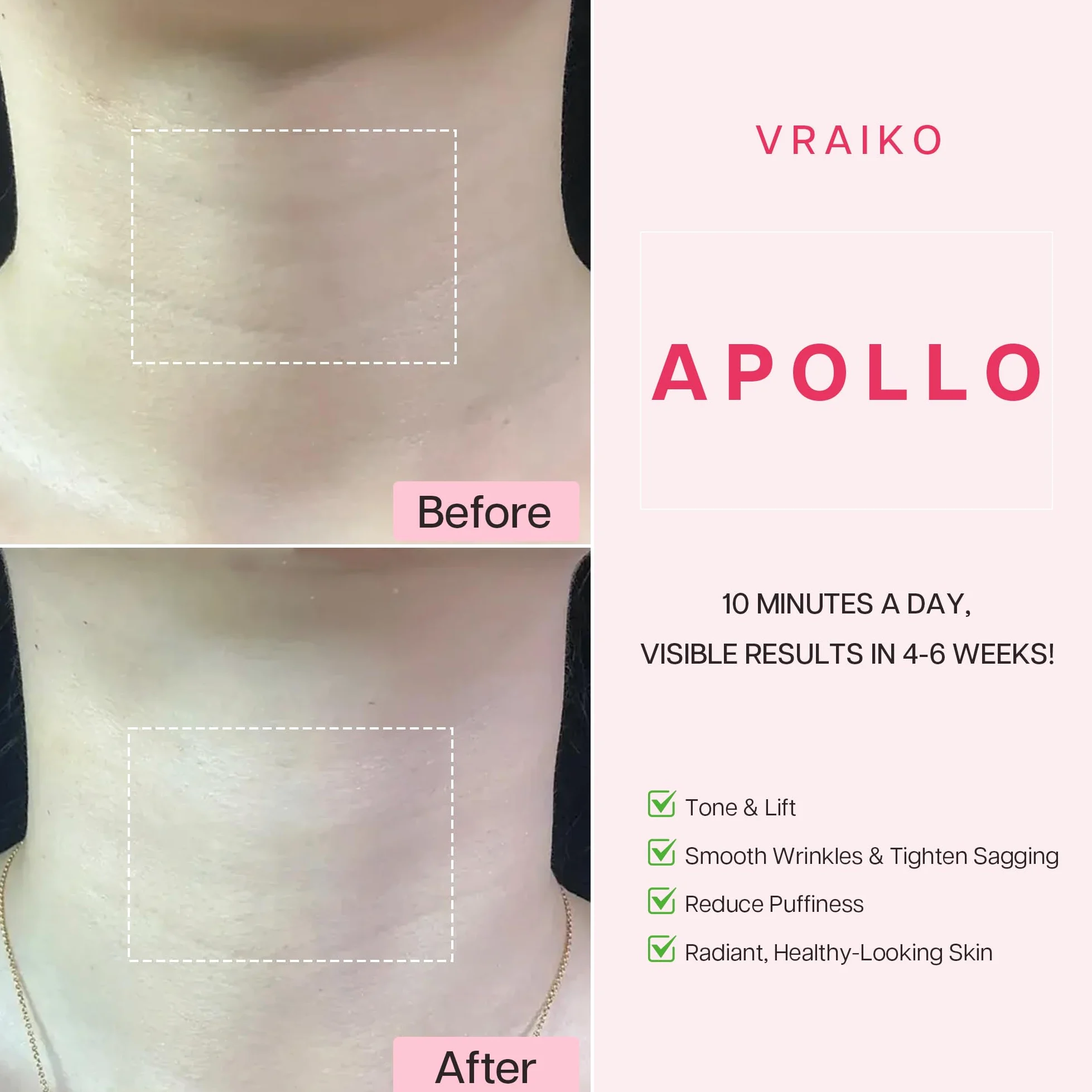 VRAIKO APOLLO masażer do liftingu szyi, EMS Gua Sha, podwójne działanie LED, wodoodporny IP65