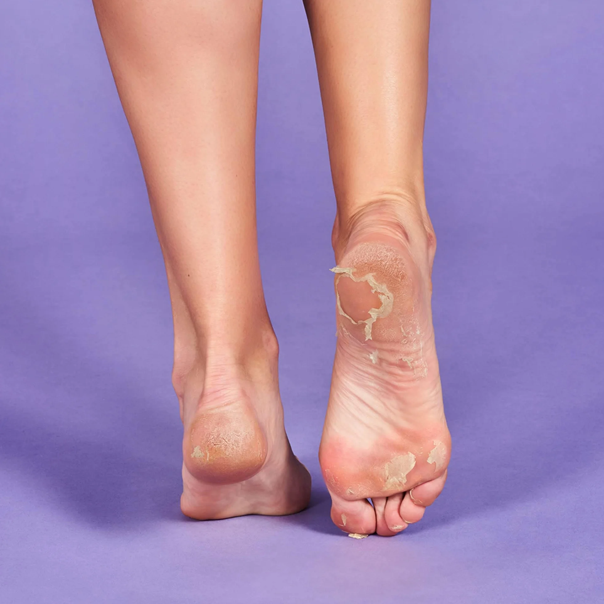 Iroha Nature Exfoliations Socks Lavendel skarpety do peelingu, 1 opakowanie (1 x 2 sztuki)