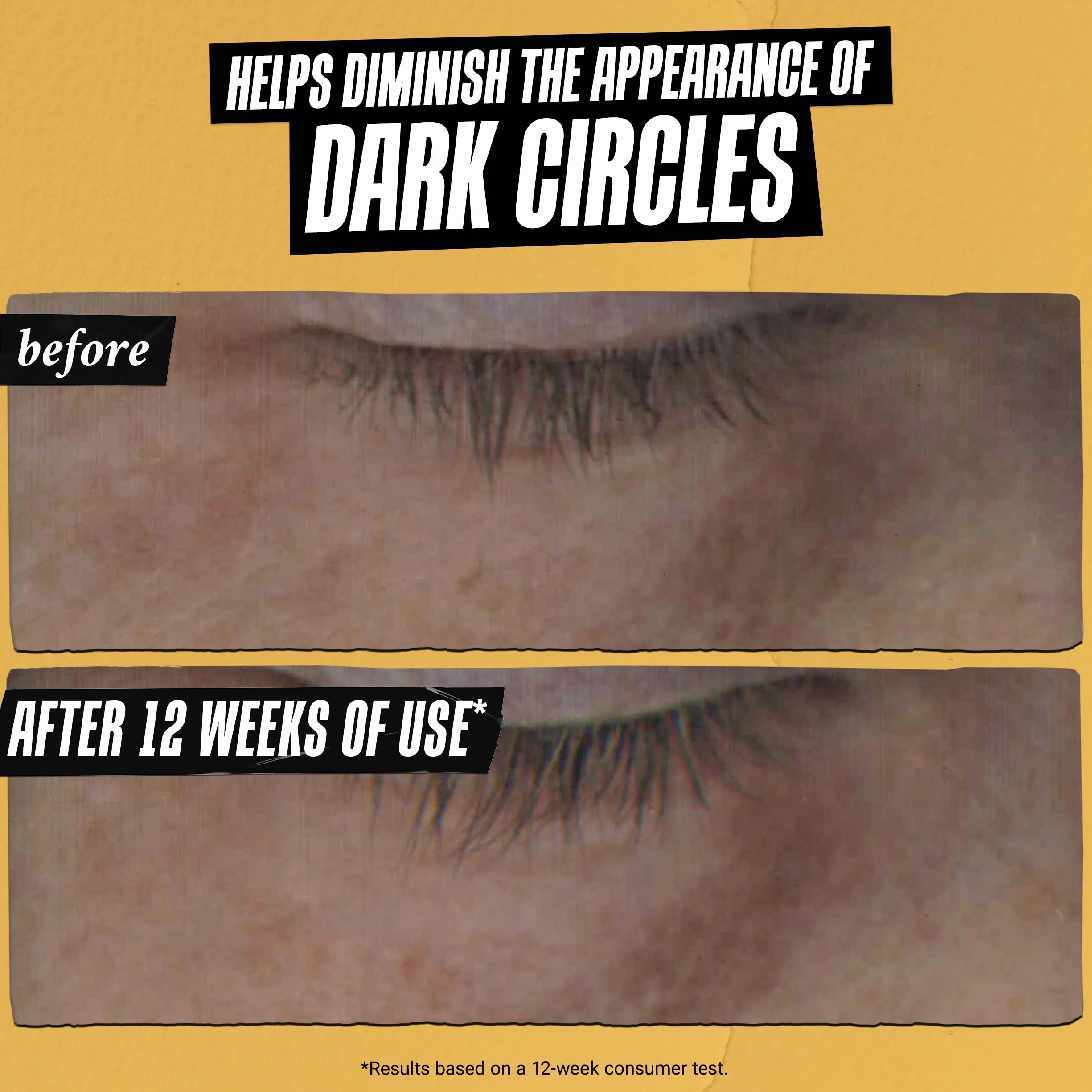 Kiehl's Kiehl's Powerful-Strength serum do oczu z witaminą C, redukcja linii i cienie pod oczami
