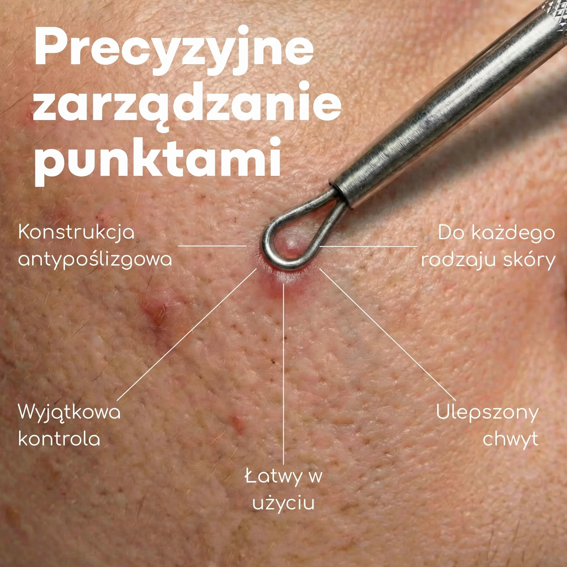 Zestaw do Usuwania Zaskórników 7 Szt., Medi Grade Zestaw do Wyciskania Pryszczy ze Stali Nierdzewnej, Przyrząd do Usuwania Zaskórników, Wągrów, Pryszczy i Więcej, Zestaw do Oczyszczania Twarzy