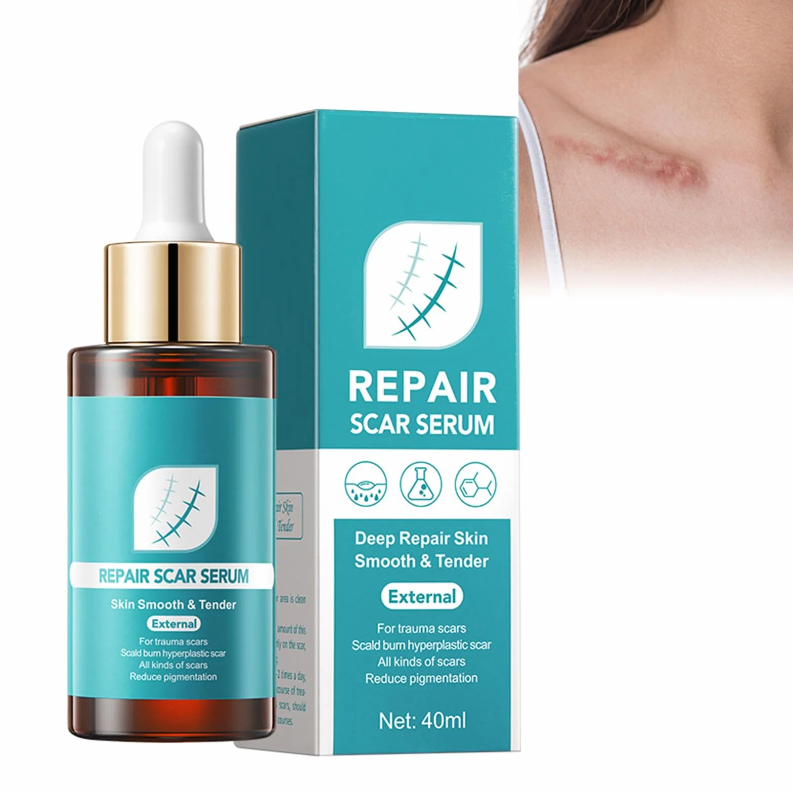 Serum do blizn, serum na blizny, serum na rozstępy, łagodniejsze blizny, bardziej elastyczne i mniej widoczne, stare i nowe blizny, usuwanie blizn