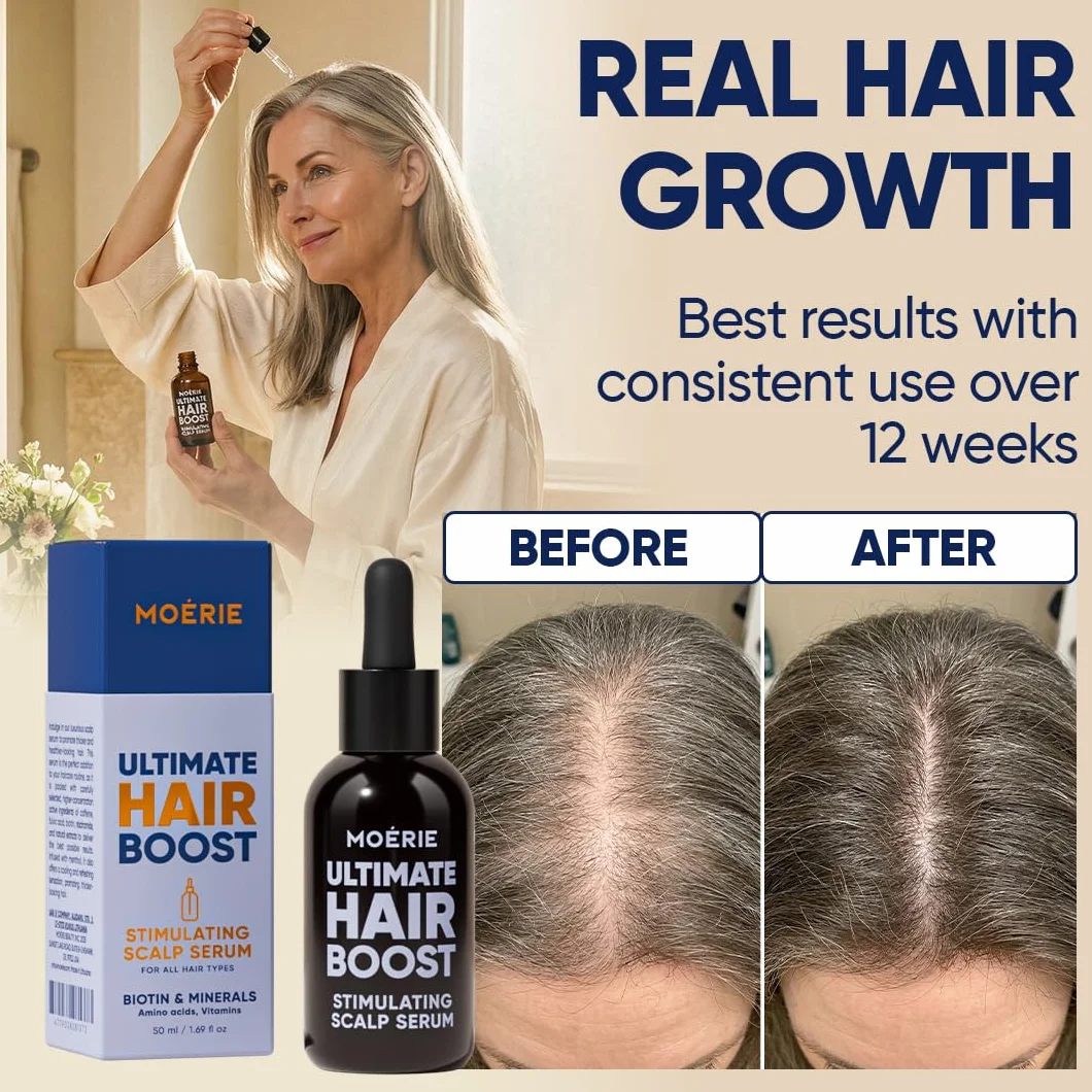MOERIE Hair Growth Serum 50 ml – przyspiesza porost włosów i zapobiega wypadaniu włosów u kobiet – serum na porost włosów na skórze głowy – serum przeciw wypadaniu włosów (zestaw 2 szt.)