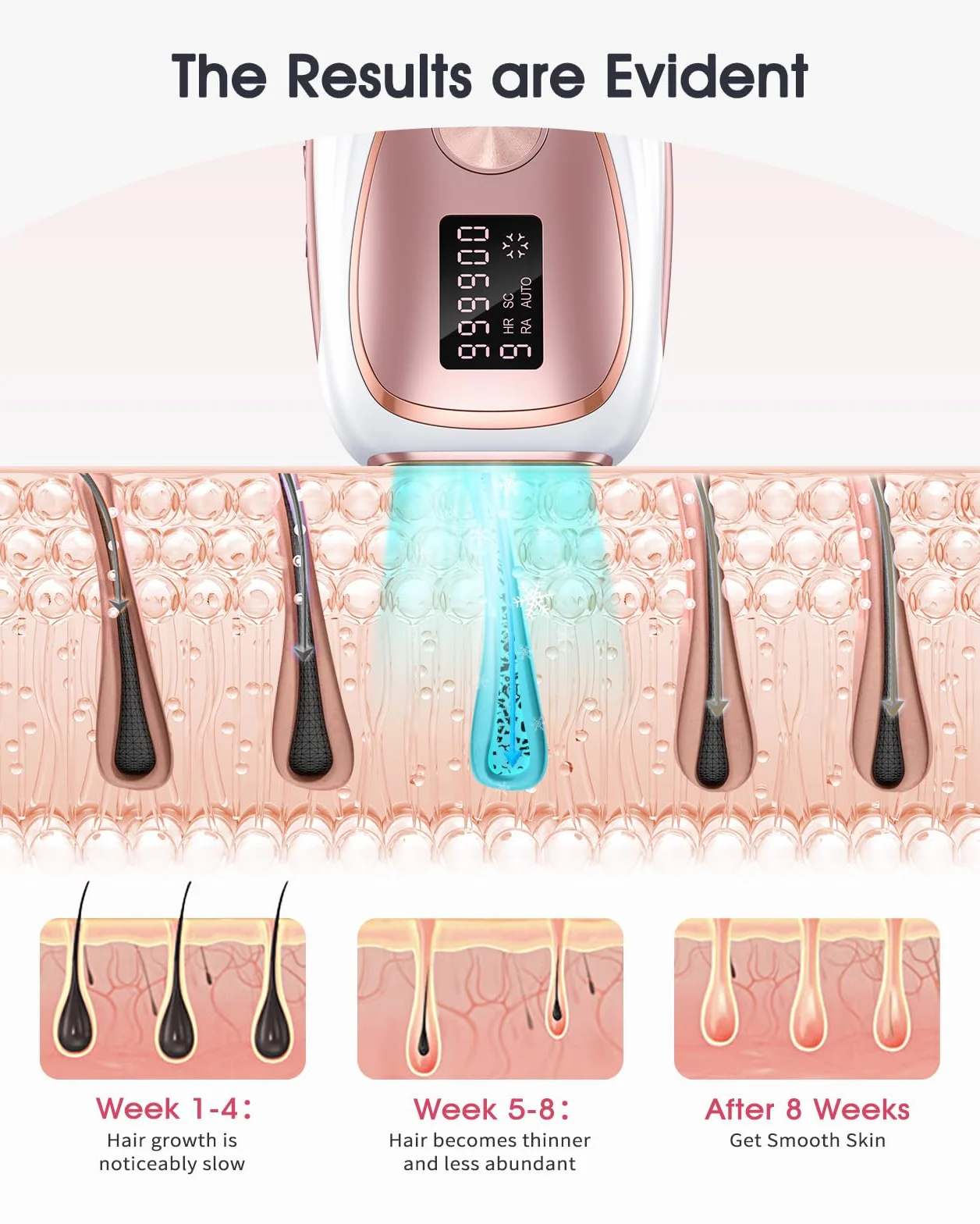 LYSMOSKI Laser Hair Removal with Cooling - 3 IN 1 IPL Hair Removal with 9 Levels, Painless Hair Remover Device for Women Men, for Whole Body, Home Use