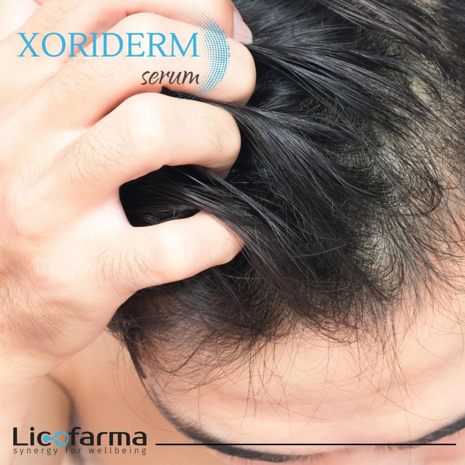 Xoriderm Serum Spray Lotion balsam w sprayu dla osób z łuszczycą i atopowym zapaleniem skóry głowy