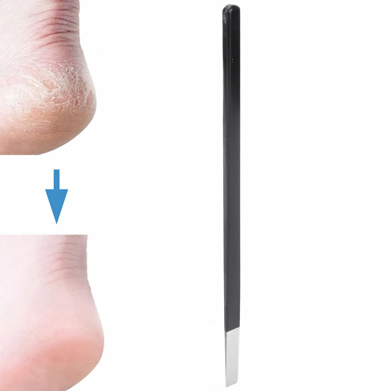 Nóż do Pedicure Narzędzia do Noża Wrastającego Paznokcia ze Stali Nierdzewnej Płaskie i Zaostrzone Ostrze Narzędzie do Usuwania Martwego Naskórka Narzędzie do Usuwania Paznokci z Pilnikiem do Paznokci