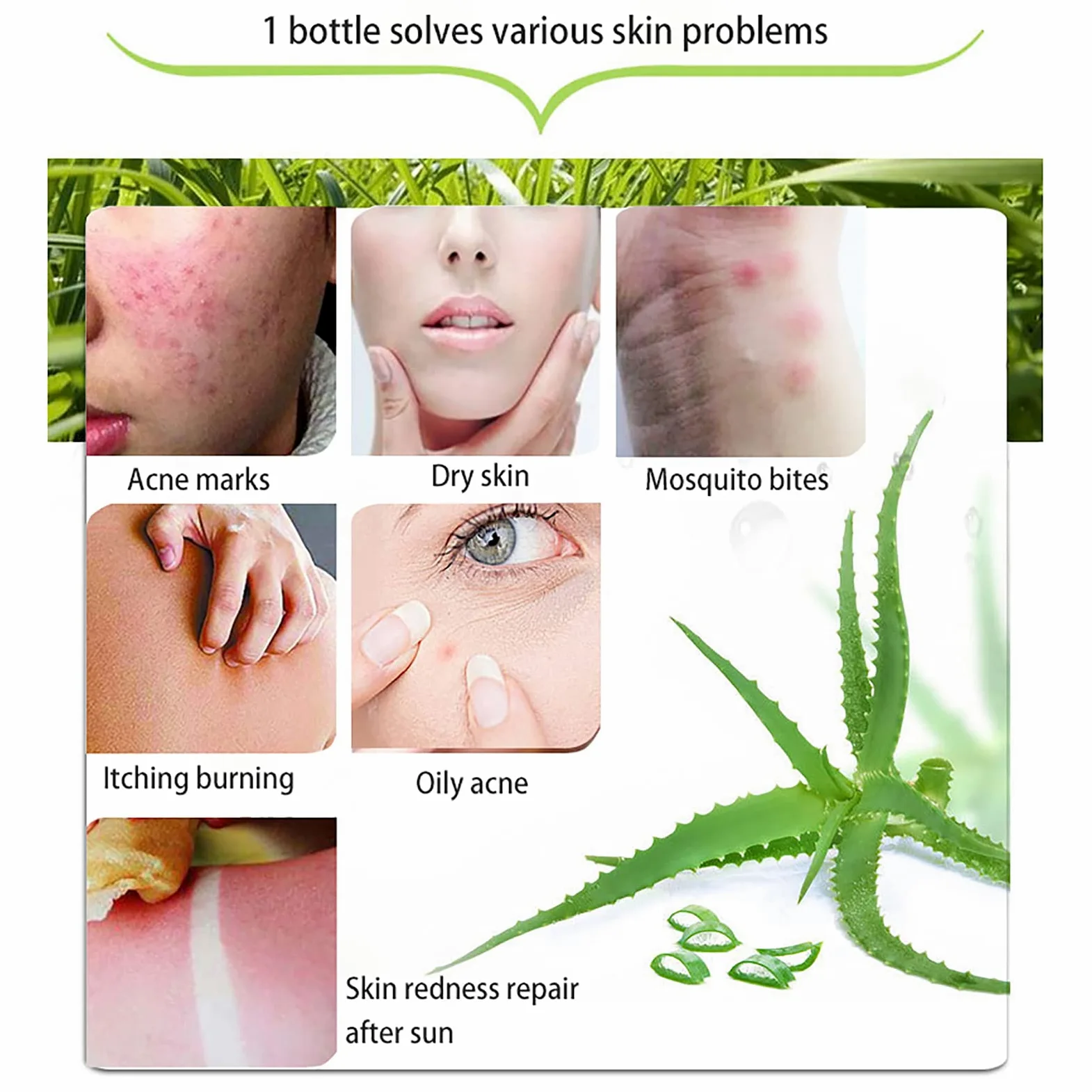 Żel Aloe Vera 300 x 2 ml – 99% czystego aloesu krem nawilżający do twarzy i ciała, naturalny krem z aloesu do suchej skóry, oparzeń słonecznych, trądziku
