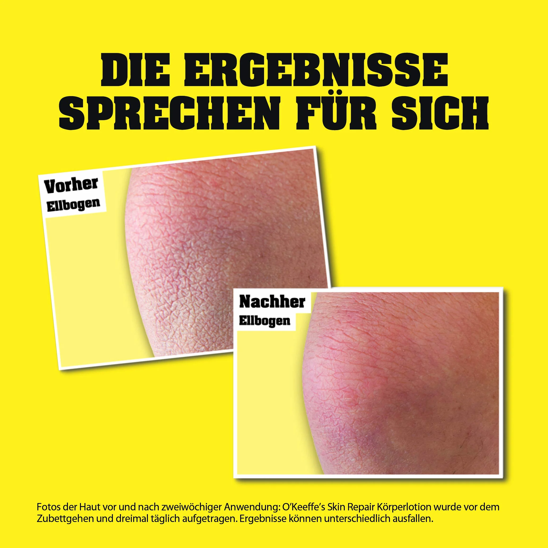 O'Keeffe's Skin Repair balsam do ciała w tubce, 190 ml
