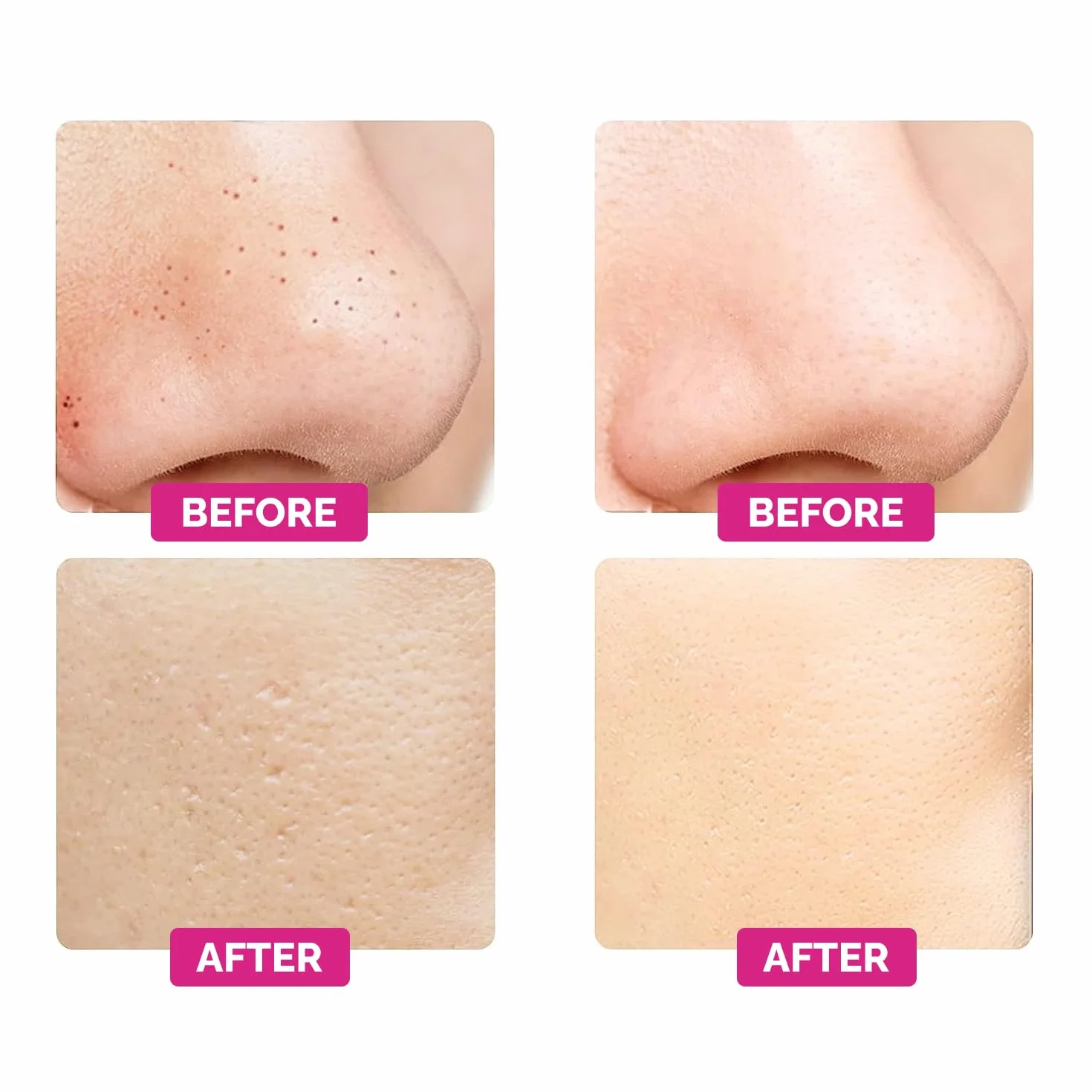 Gess Mamba Ultradźwiękowa Peeling Do Skóry Elektryczny Skin Scrubber Twarzy Oczyszczacz Porów
