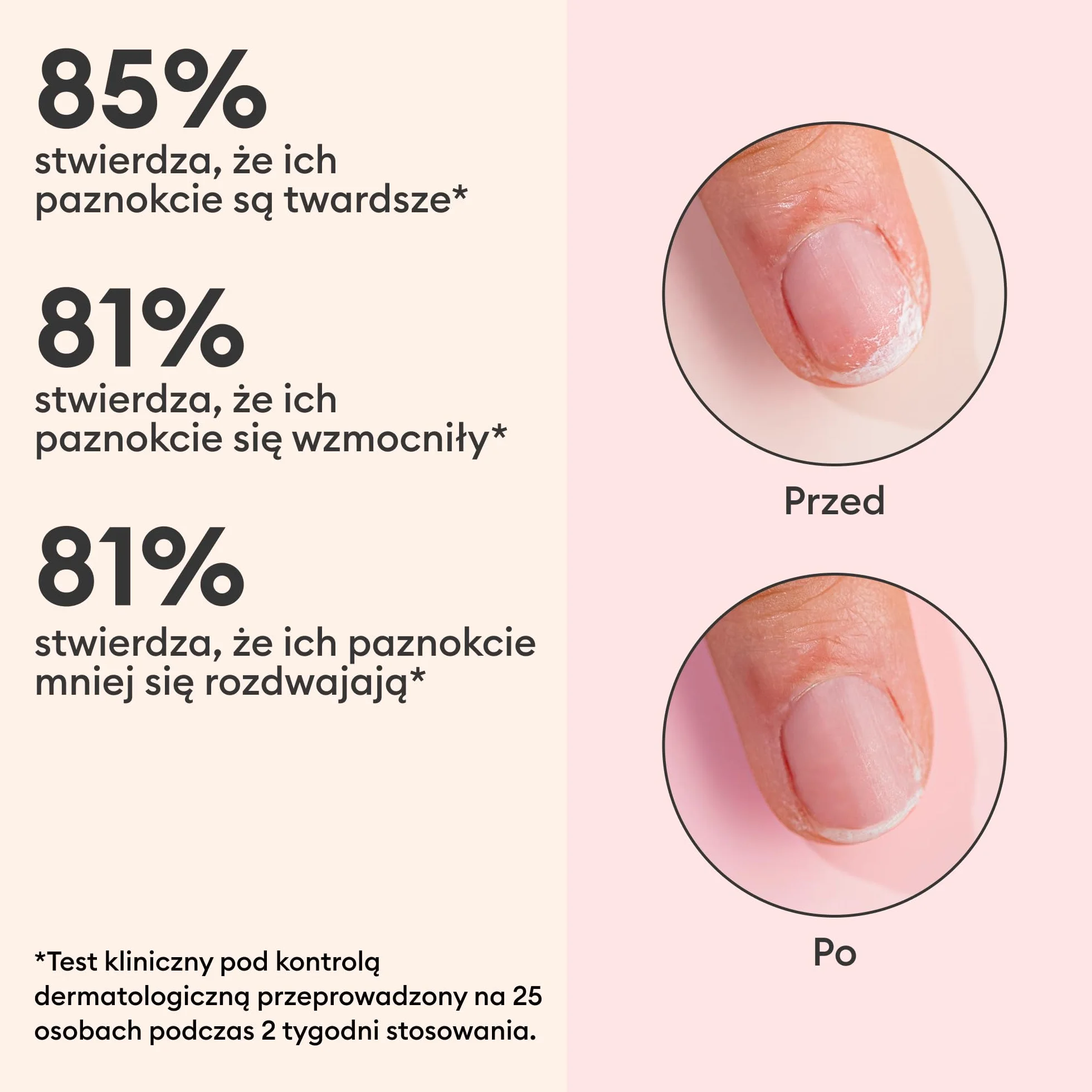 Manucurist Kératine Booster – Utwardzacz do Paznokci – Regeneracja Kruchych i Osłabionych Paznokci – Roślinna Keratyna, AHA, PHA, MSM, Krzem i Witamina B8 – 97,5% składników pochodzenia naturalnego