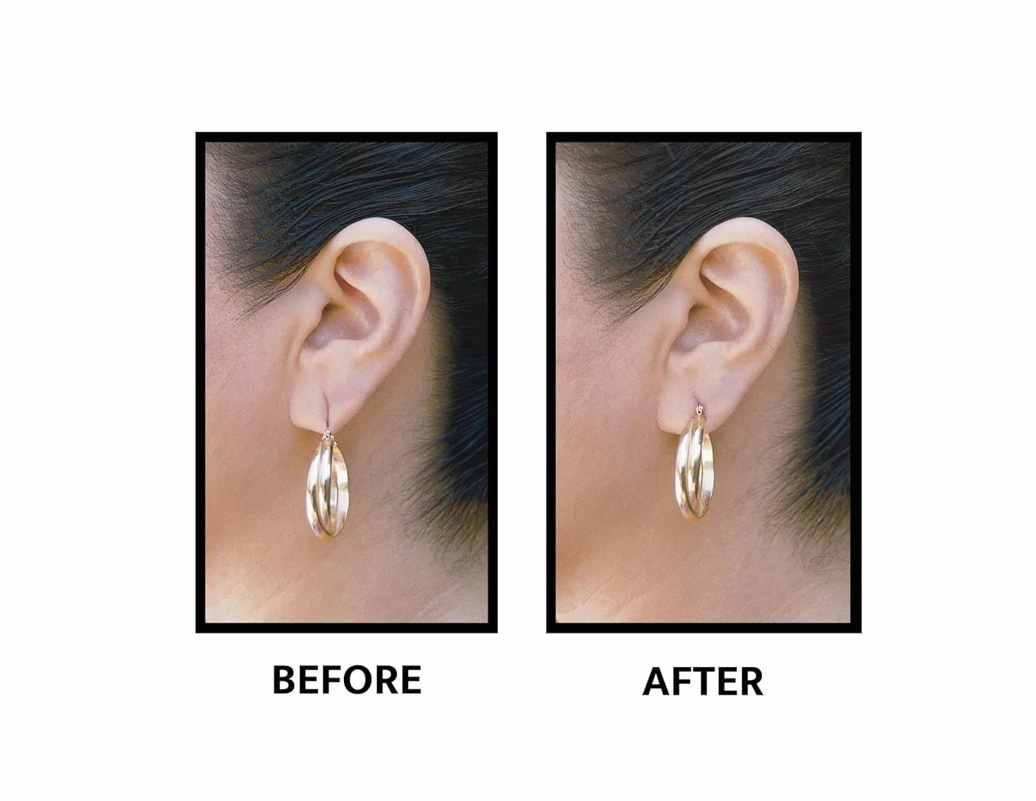 Lobe Miracle 60 naszywek