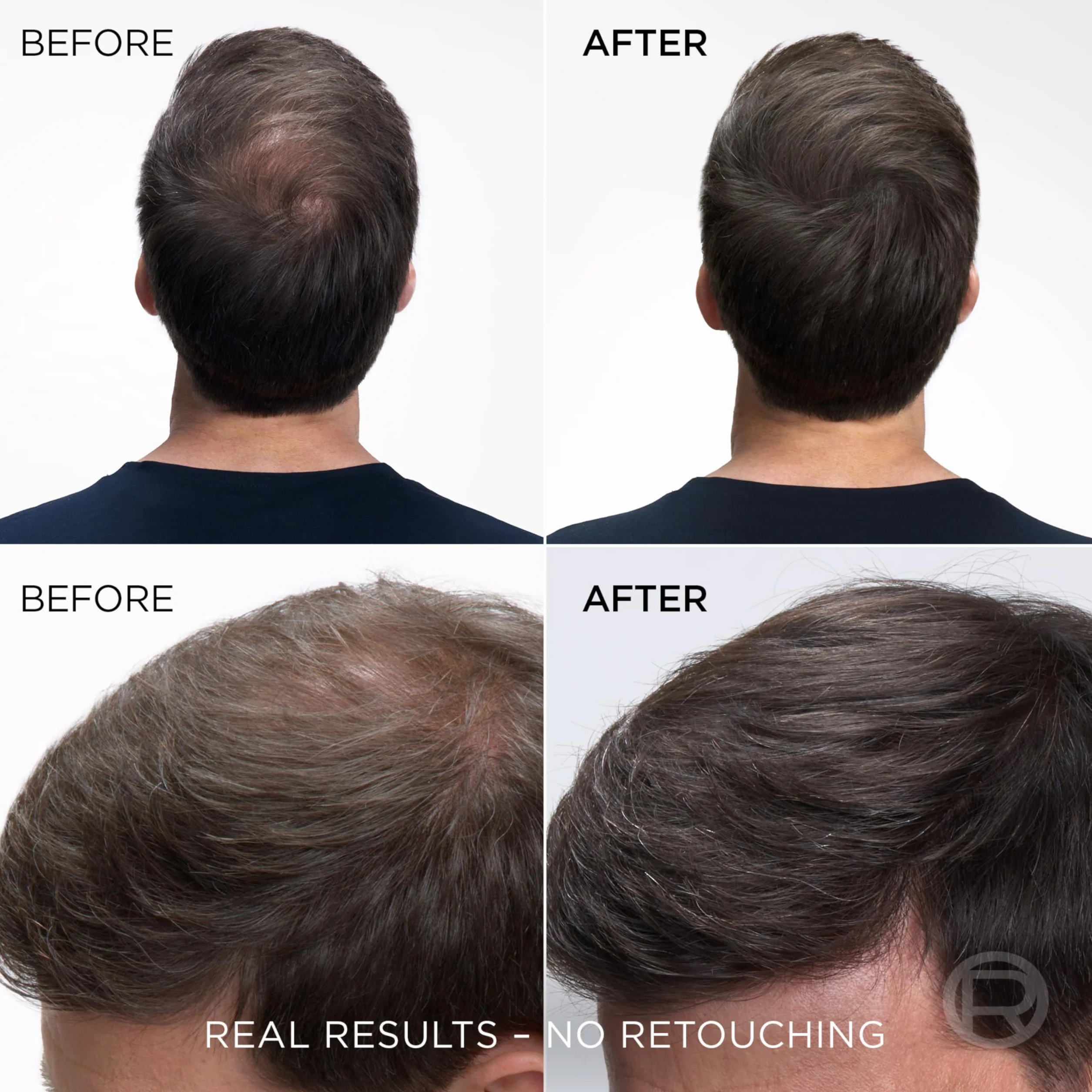 L'Oréal Magic Retouch Instant Root korektor w sprayu, idealny do odświeżania szarych korzeni, 75 ml, kolor: brązowy mahoniowy