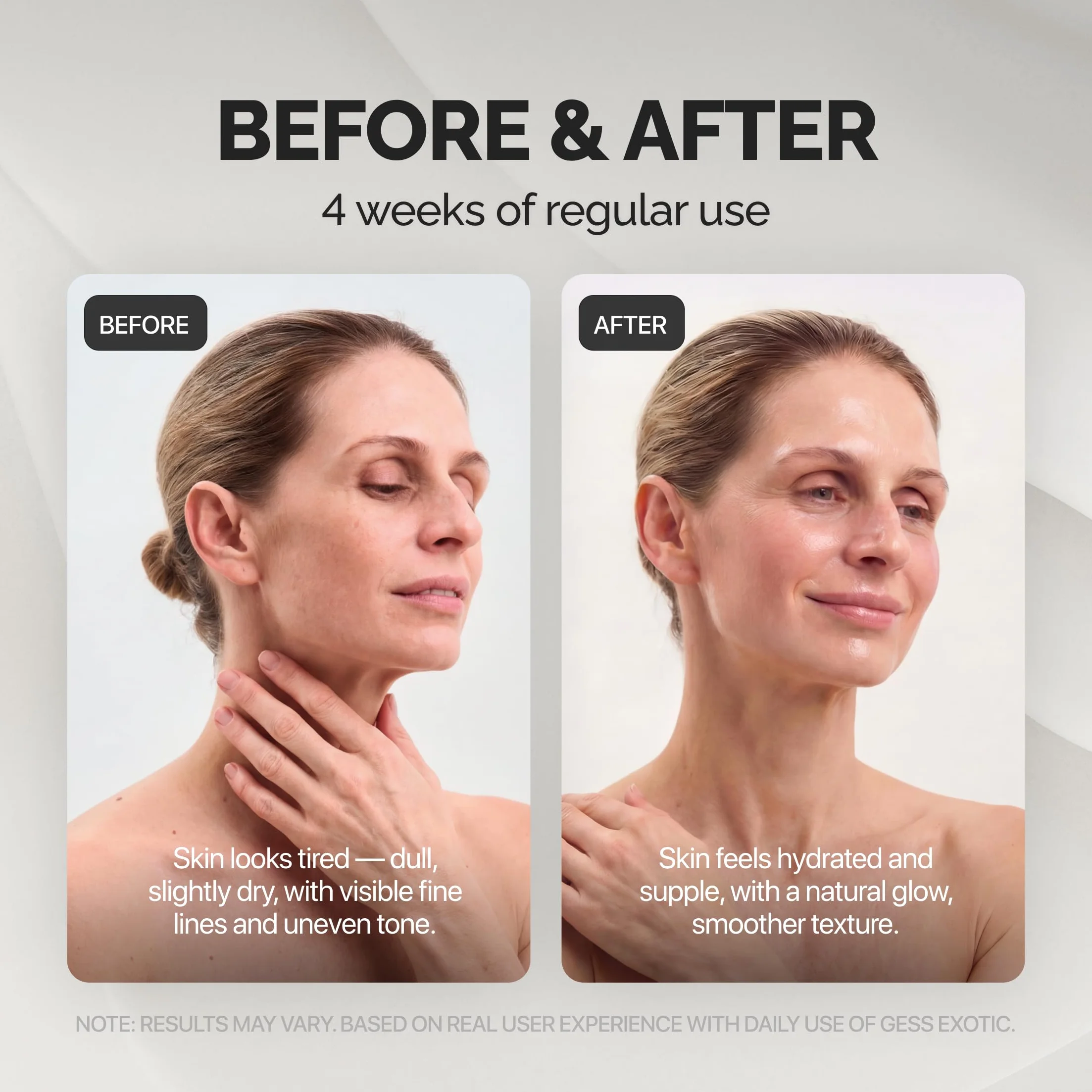 GESS Exotic: 7-w-1 Ultradźwiękowy Peeling Twarzy do Oczyszczania, Peeling Ultradźwiękowy do Zmarszczek i Oczyszczania Porów, pielęgnacja skóry, głębokie oczyszczenie, profesjonalna pielęgnacja w Domu