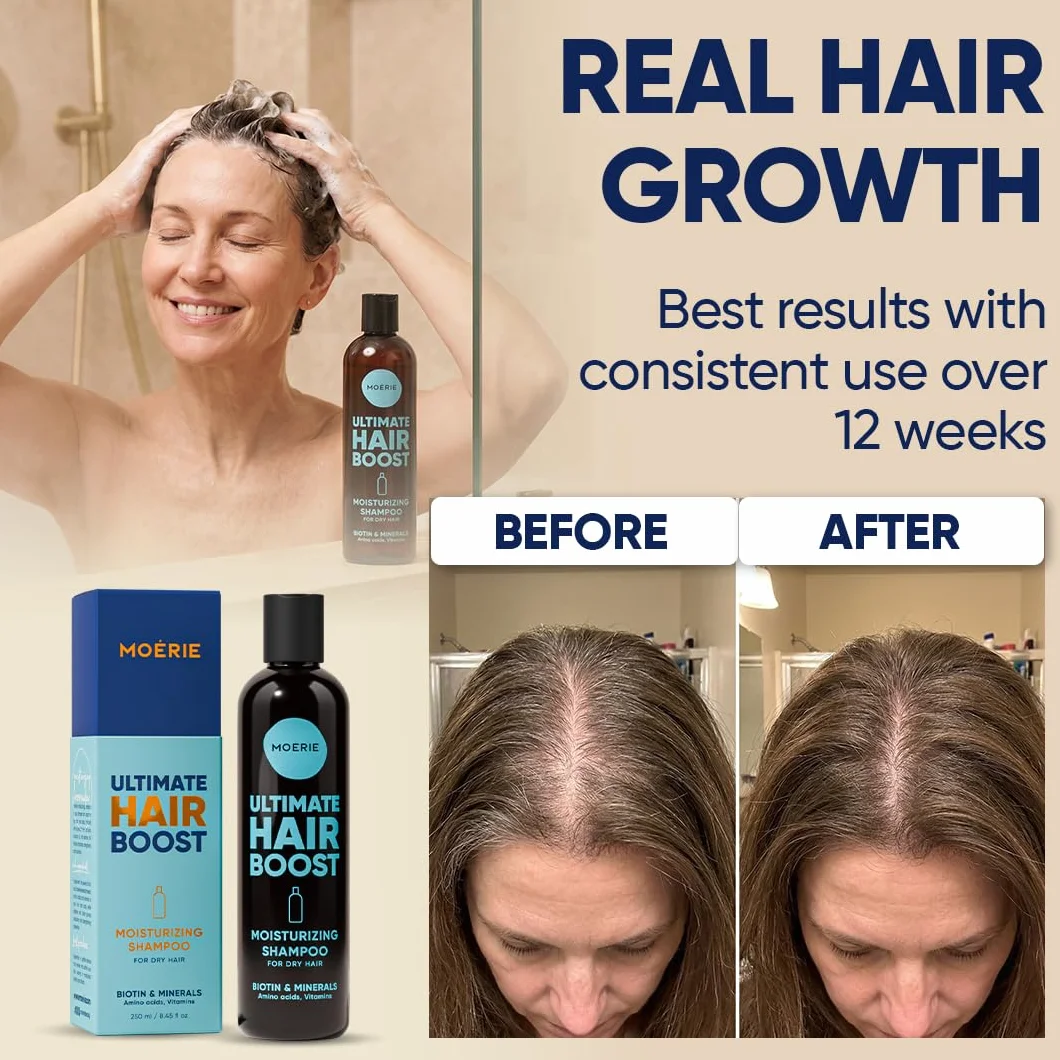 Moerie Ultimate Hair Growth Shampoo – dla dłuższych, grubszych, pełnych włosów – wegańskie, przyjazne dla skóry – bez parabenów i silikonu – wszystkie rodzaje włosów – odwrotne wypadanie włosów