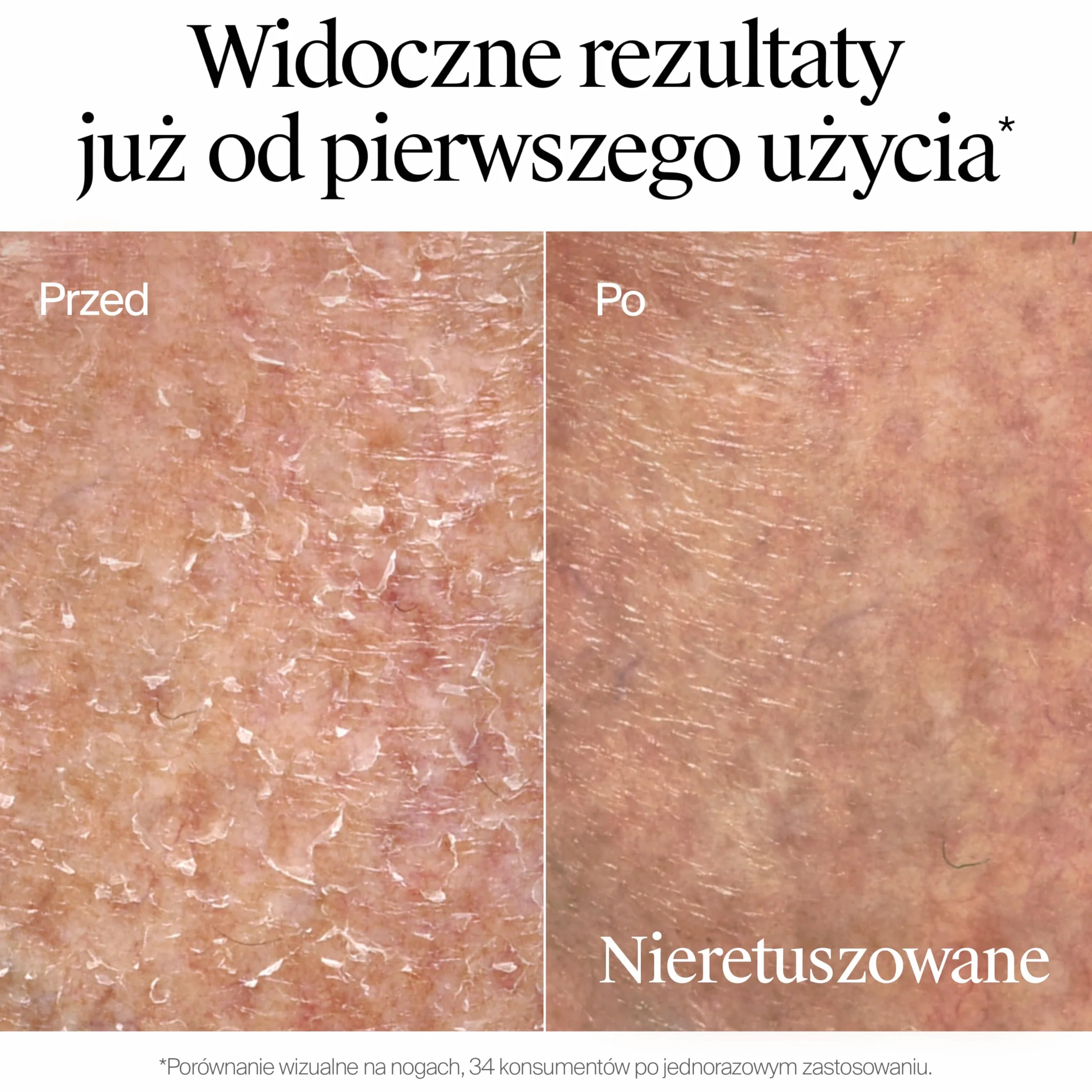 Neutrogena Formuła Norweska Intensywnie Regenerujący Balsam do Ciała z CICA 400ml