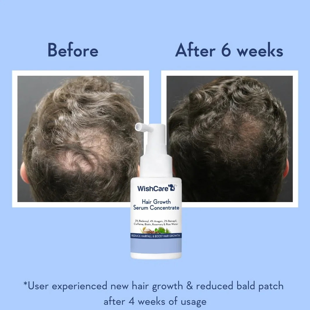 WishCare Serum na Porost Włosów z Rozmarynem, Redensyl, Anagain, Baicapil, Kofeiną, Biotyną
