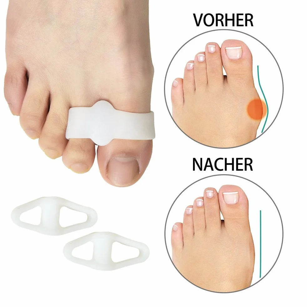 4 silikonowe separatory do palców Hallux Valgus, młotkórek, kurzyste oczy, duży palec + neb