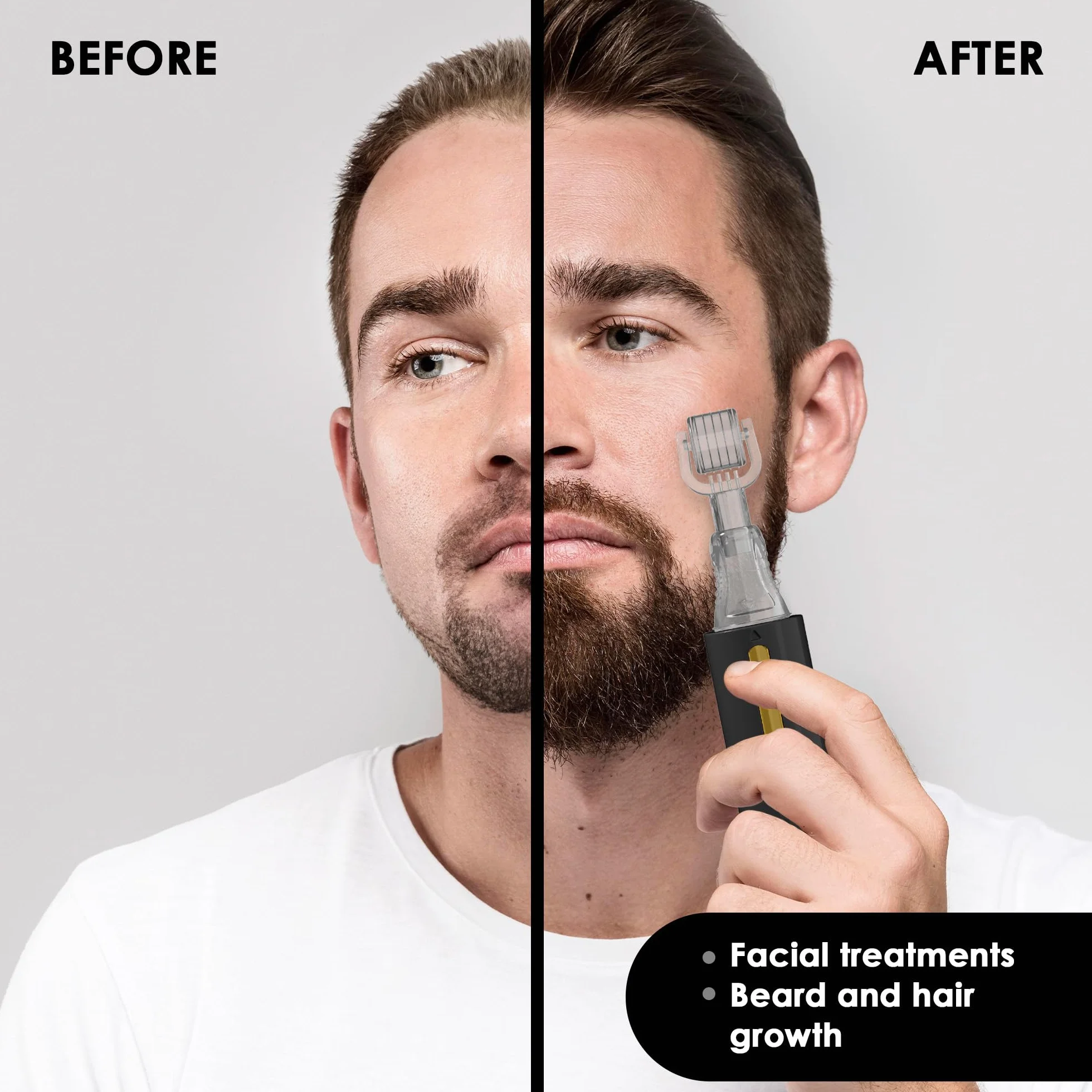 HAMINOS Derma Roller 0,25 mm z Pojemnikiem 105 igieł tytanowych do Włosów, Brody, Skóry