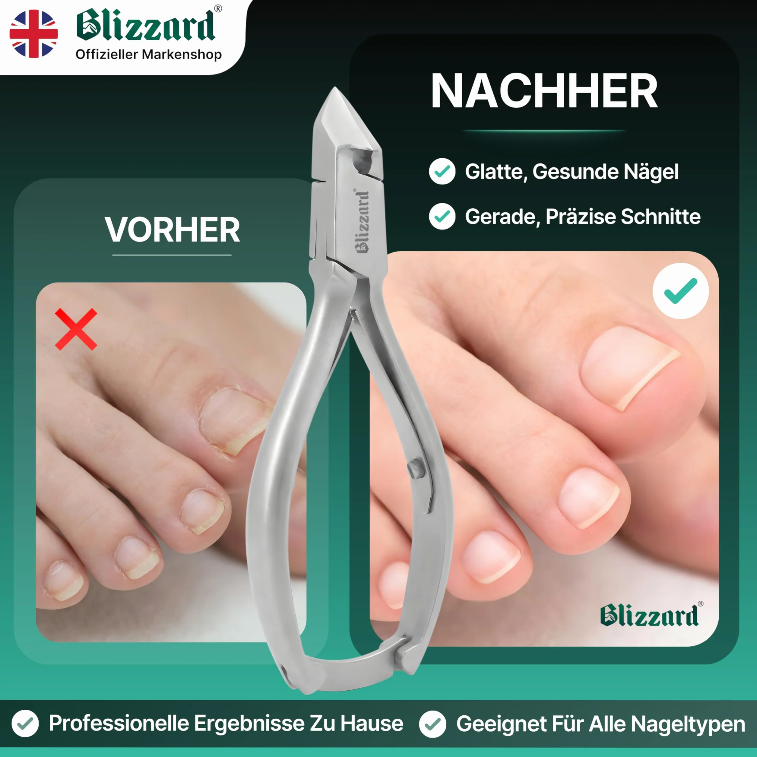 Obcinacze do Paznokci dla Mężczyzn z Grubymi lub Wrastającymi Paznokciami - Blizzard Cążek Wyrób Niemiecki - 14 cm, Duża Wytrzymałość - Ostrze Półksiężyc Gładkie Rączki - Klasa Szpitalna