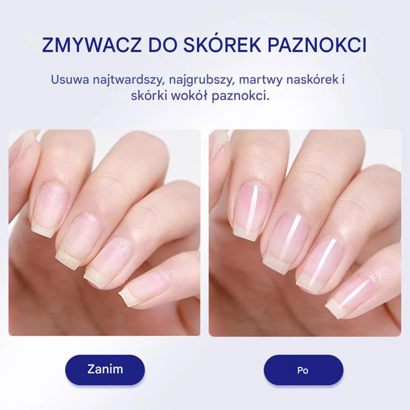 30ml Cuticle Remover Liquid, Hydrating Manicure Tool for Dry, Damaged, or Brittle Nails, Hangnails, Dead Skin, Hands and Feet, Routine, Home or Salon Use, Soft, Smooth, Easy Cuticle Care