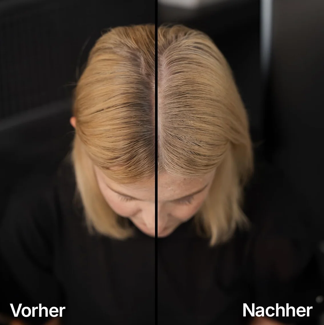 LEON MIGUEL Puder do nasady – wodoodporny puder Hairline Powder jako idealny korektor do zakrywania nasady, niewidoczny makijaż włosów do zagęszczania włosów (ciemnobrązowy, Hairline Powder Pro)