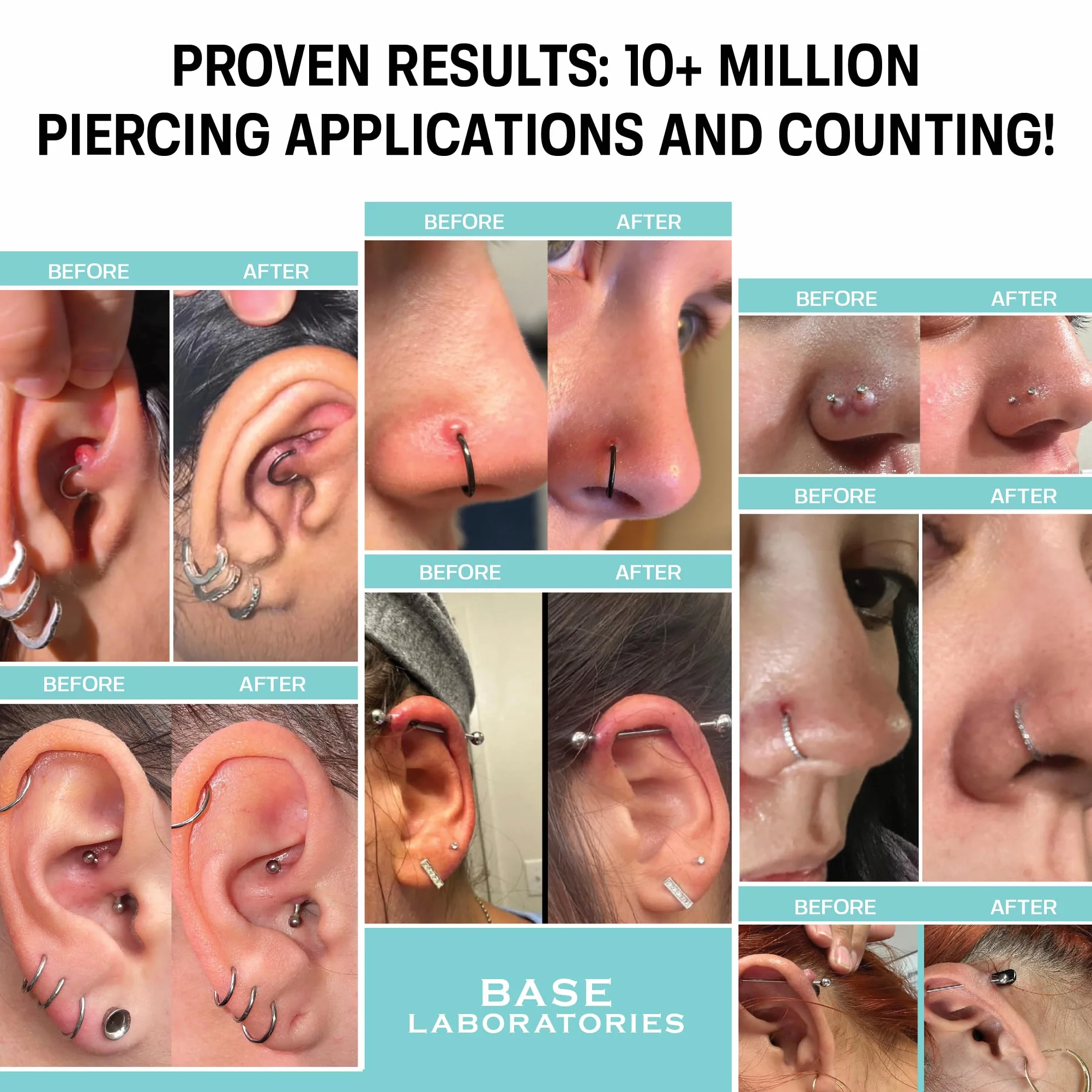 base labs piercing aftercare kit