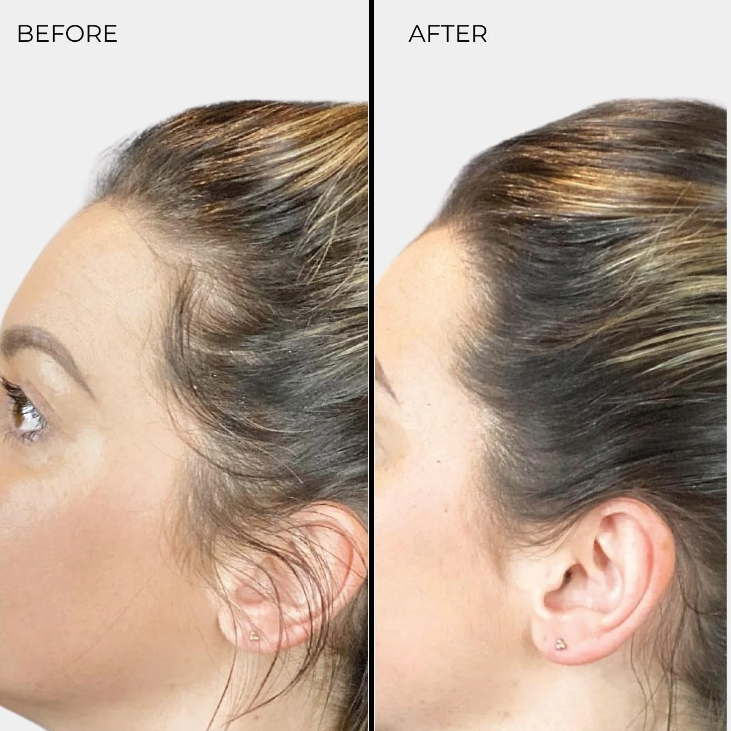 Nanogen Keratin włókna zagęszczające do włosów, 15 g, ciemny blond