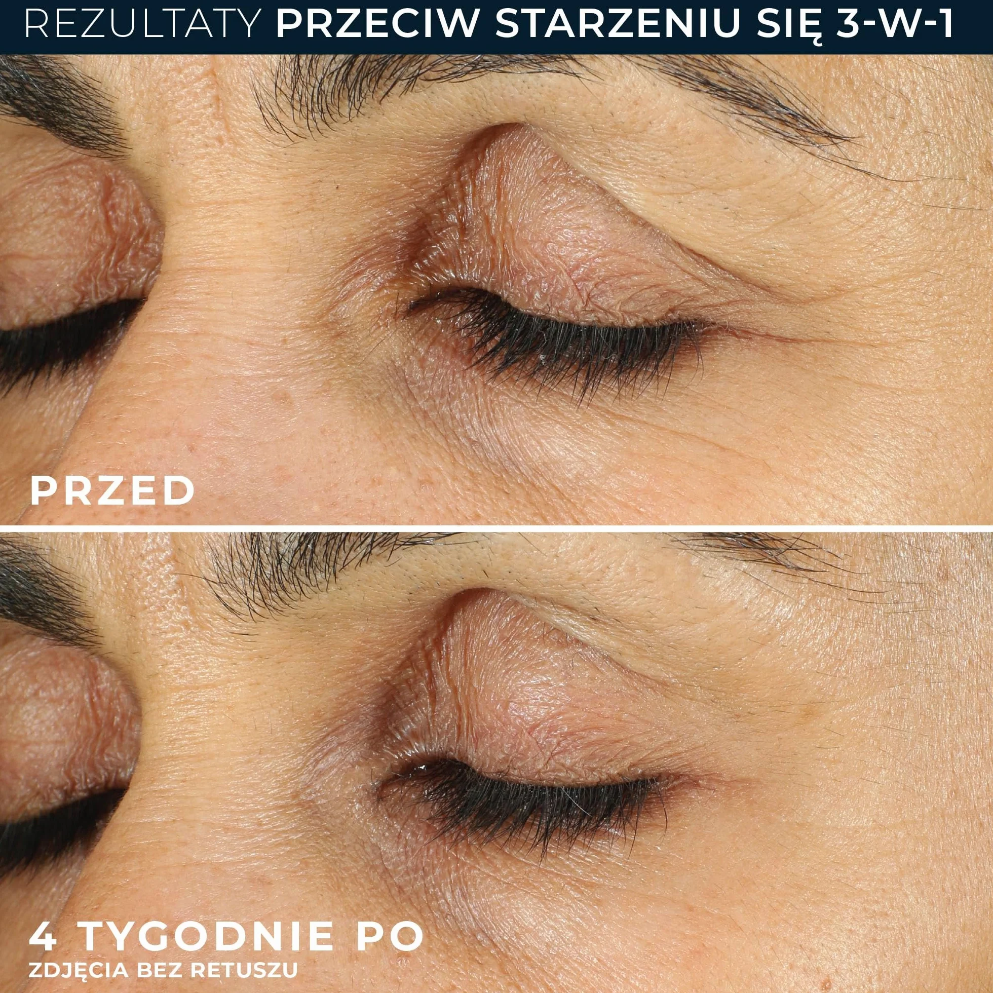RoC Retinol Correxion Line Smoothing krem pod oczy 15 ml przeciwzmarszczkowy