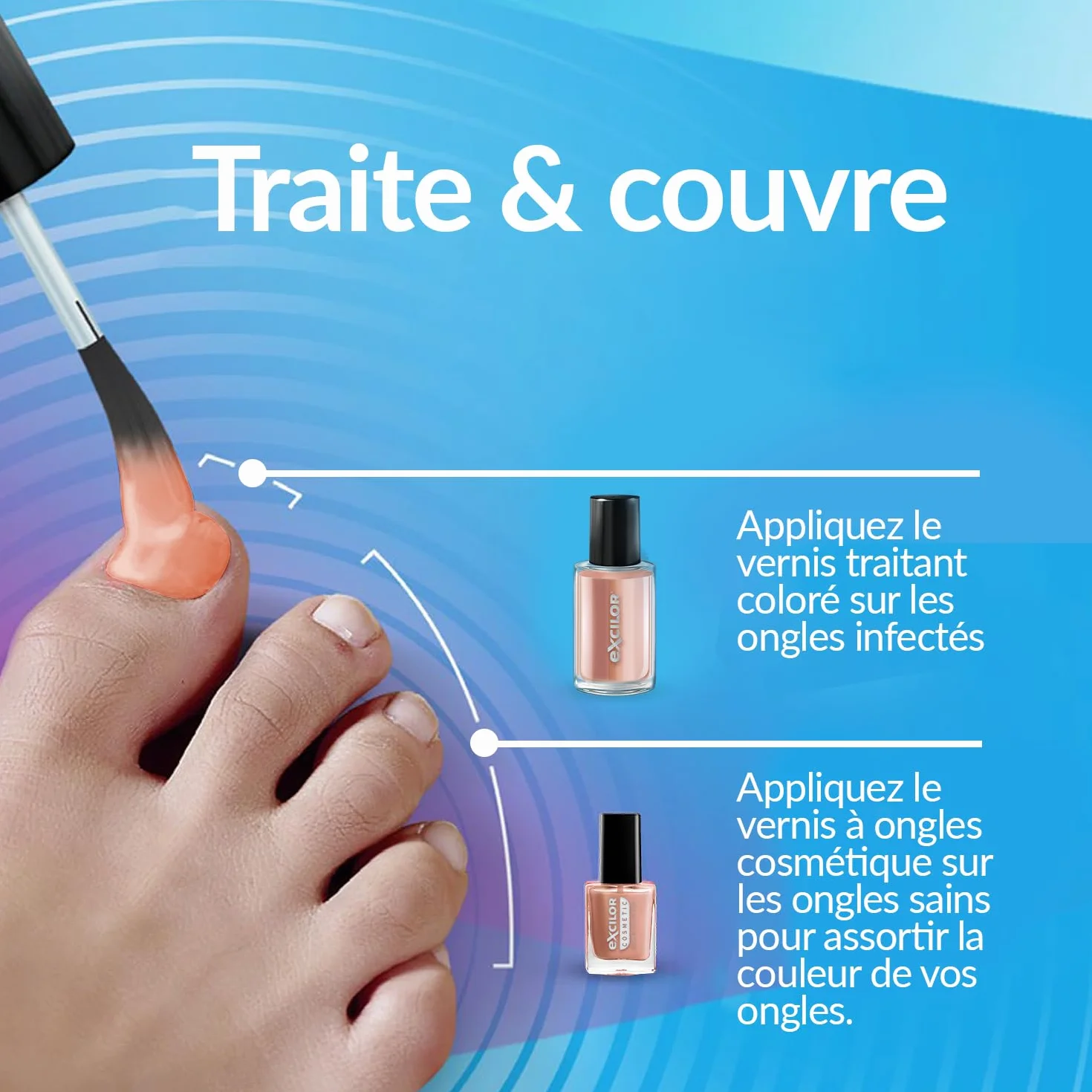 EXCILOR - Forte Color - Leczenie grzybicy paznokci - Dojenie i okładki - Zabieg 30ml + Kosmetyczny lakier do paznokci 8ml - Udowodnione klinicznie* - Nude