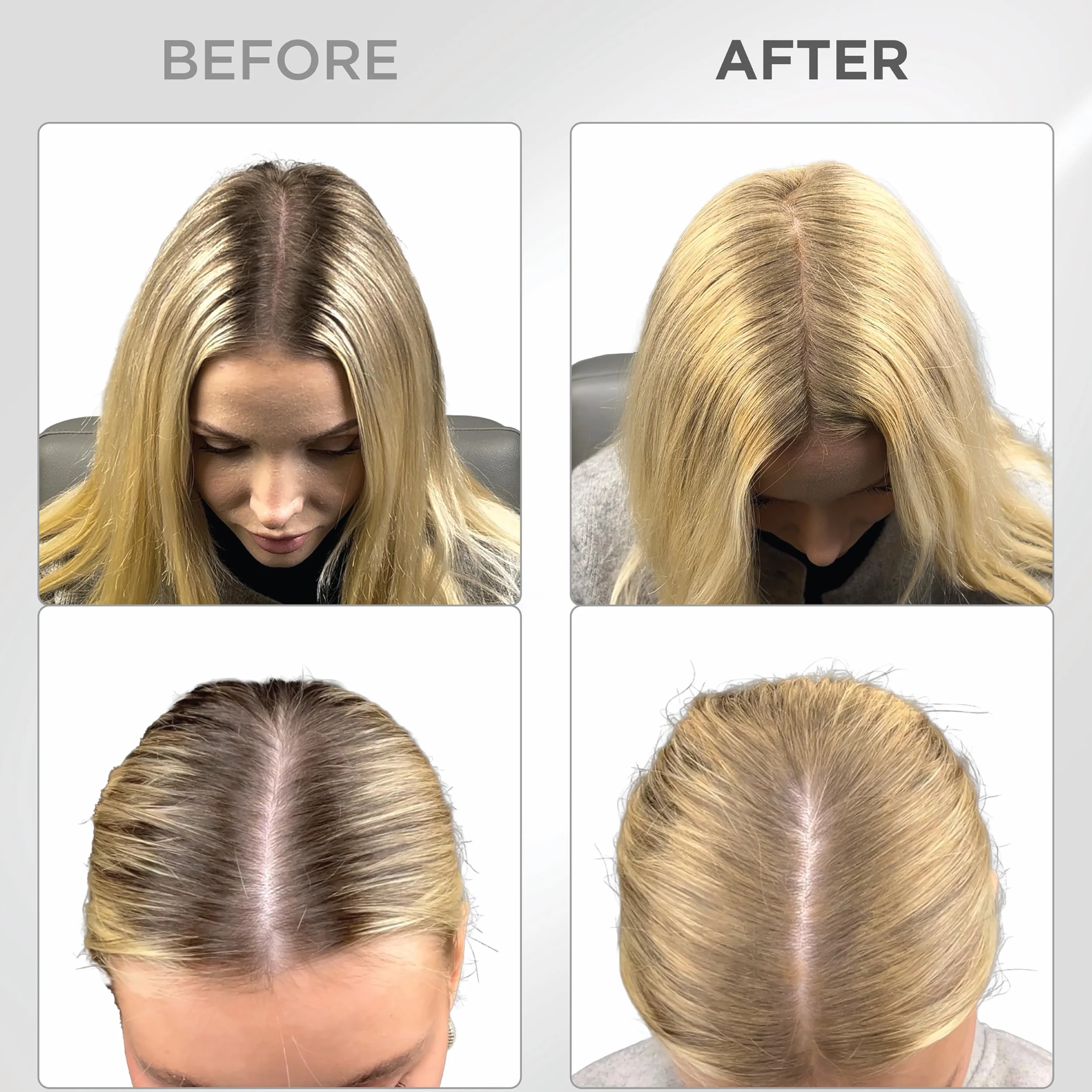THICK FIBER Root Touch Up Puder do przerzedzonych włosów dla kobiet, zestaw do maskowania wypadających włosów, odporny na wodę i pot, z pędzelkiem (blond)