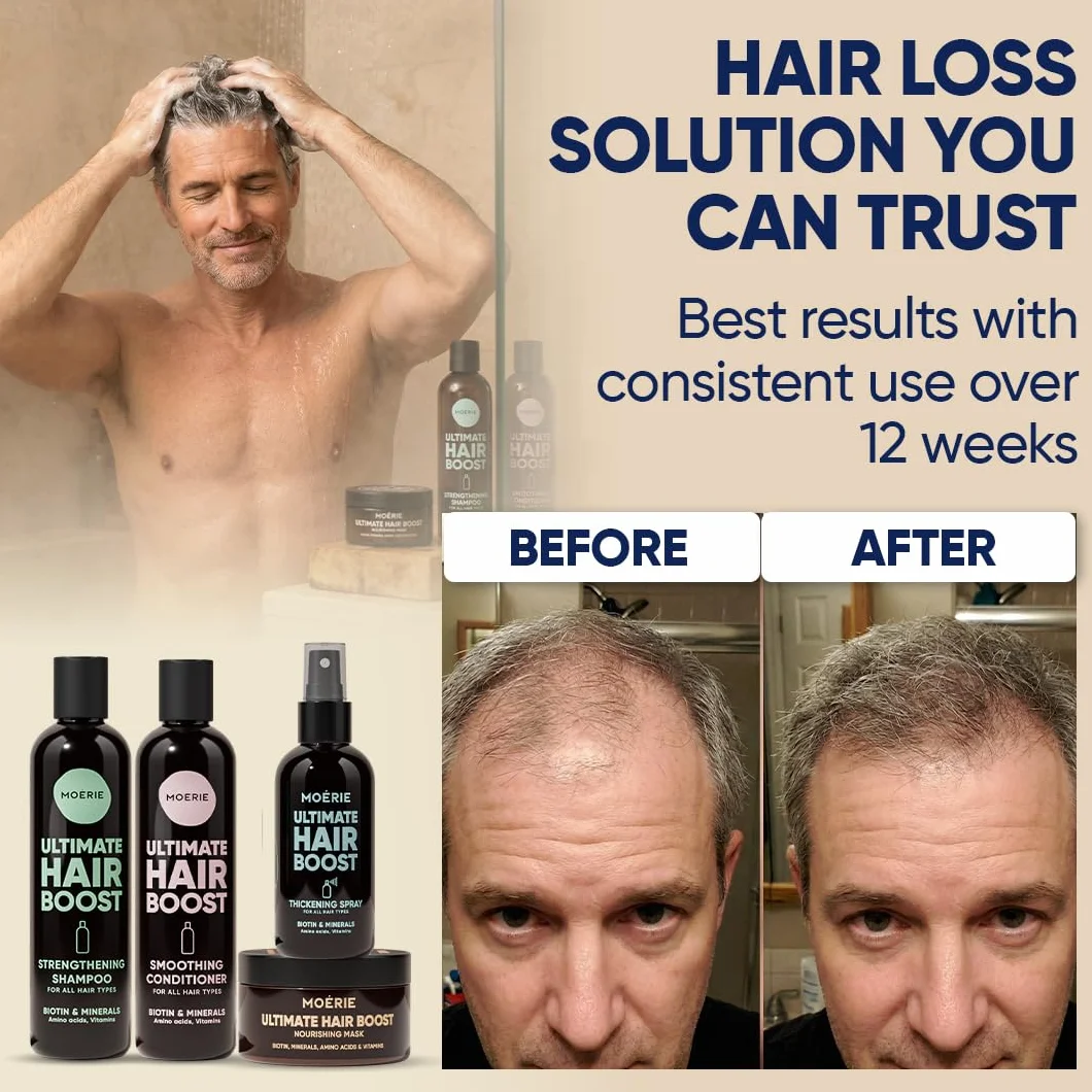 Moerie Mineral Shampoo and Conditioner Plus Hair Mask and Hair Spray Mega Pack – The Ultimate Hair Care Set – For Longer, Thicker, Fuller Hair - Vegan Hair Products – Paraben & Silicone Free Products