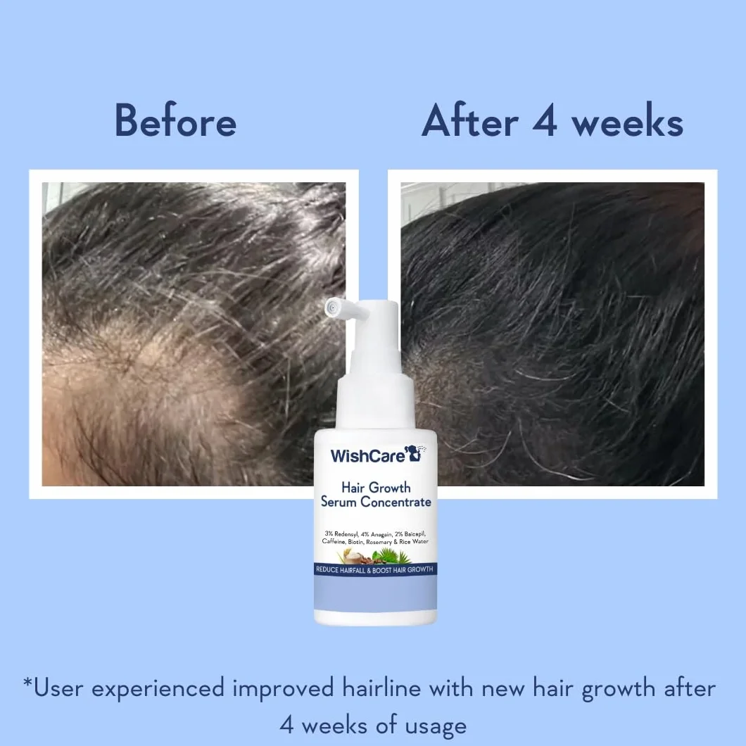 WishCare Serum na Porost Włosów z Rozmarynem, Redensyl, Anagain, Baicapil, Kofeiną, Biotyną