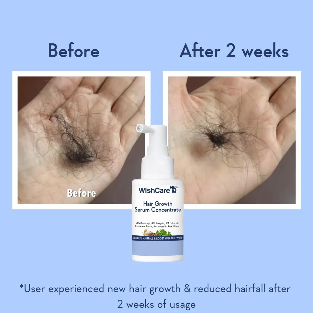WishCare Serum na Porost Włosów z Rozmarynem, Redensyl, Anagain, Baicapil, Kofeiną, Biotyną