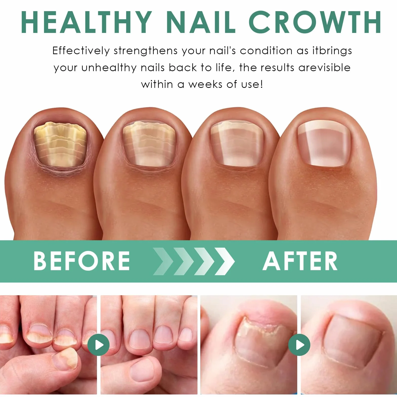 3 Kawałki Długopis do pielęgnacji paznokci,Nail Repair Solution,Pielęgnacja paznokci u nóg,Pielęgnacja palców i pedicure