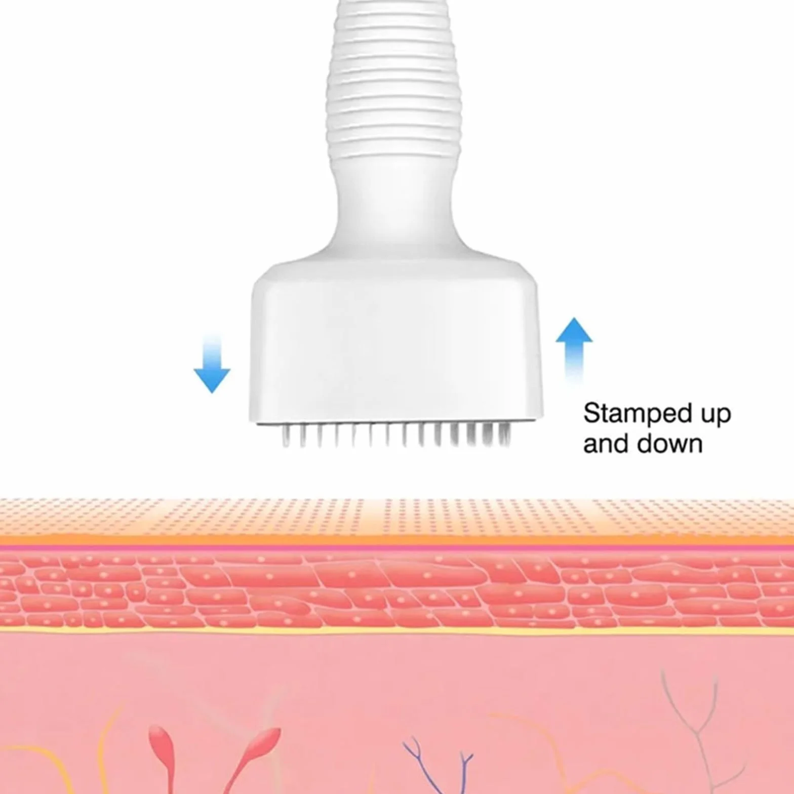 Regulowany mikroneedling Derma Stamp, 140 pinów tytanowych, profesjonalny dermapen mikroigłowy, do włosów, zarostu, twarzy, ciała