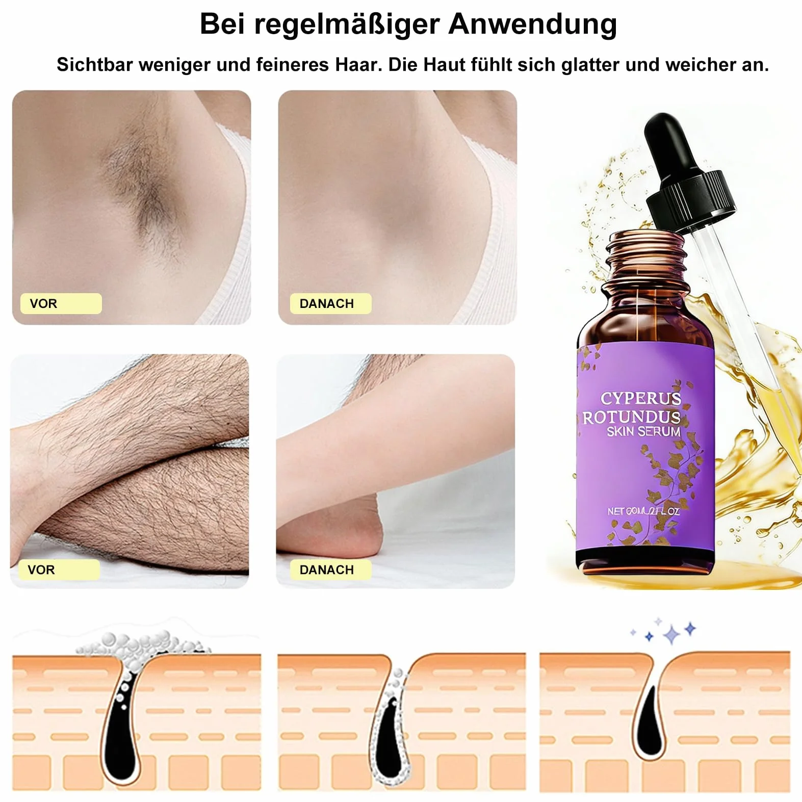 Cyperus Rotundus Oil for Hair Removal, Cyperus Rotundus olejek do depilacji, naturalny olejek cyperusowy do zmniejszenia porostu włosów, koi skórę – do ciała i twarzy