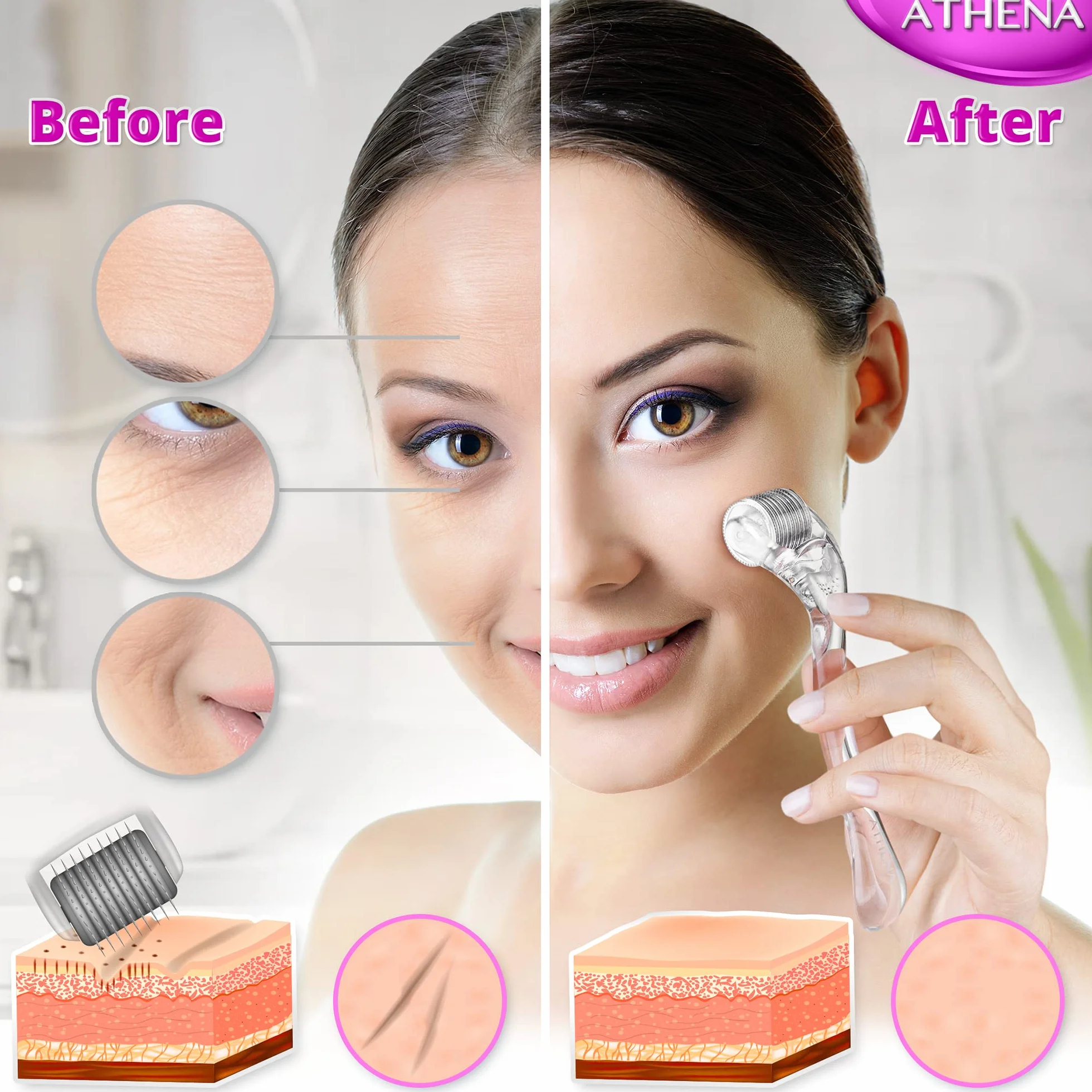 Derma Roller 540 tytanowe mikroigły (0,25 mm) do pielęgnacji skóry z etui podróżnym, ergonomiczna konstrukcja, by Athena London Skincare