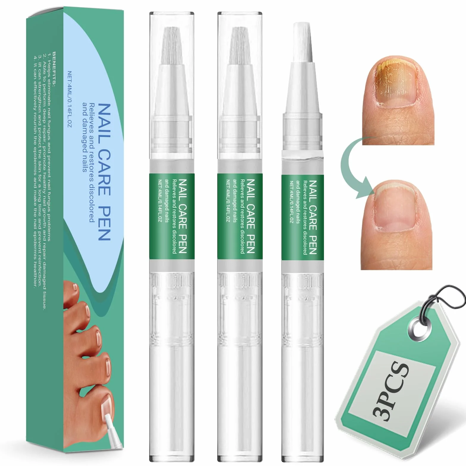 3 Kawałki Długopis do pielęgnacji paznokci,Nail Repair Solution,Pielęgnacja paznokci u nóg,Pielęgnacja palców i pedicure