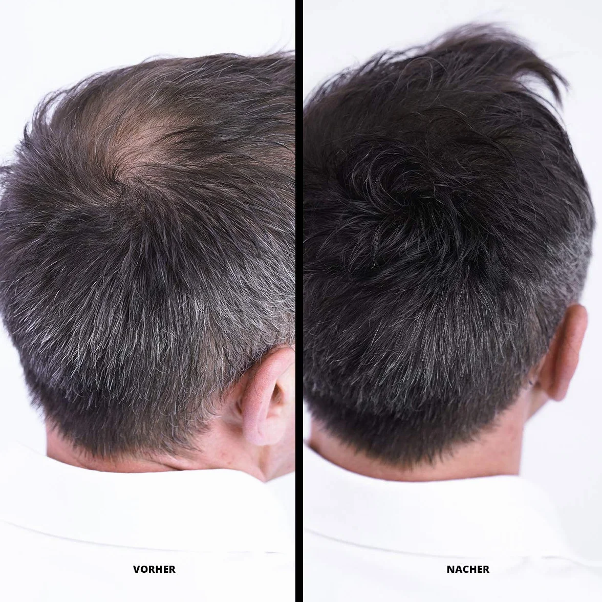 Super Million Hair - odprowadzające włókna do włosów rozjaśnionych, wypadanie włosów, 25g, średni blond (45)