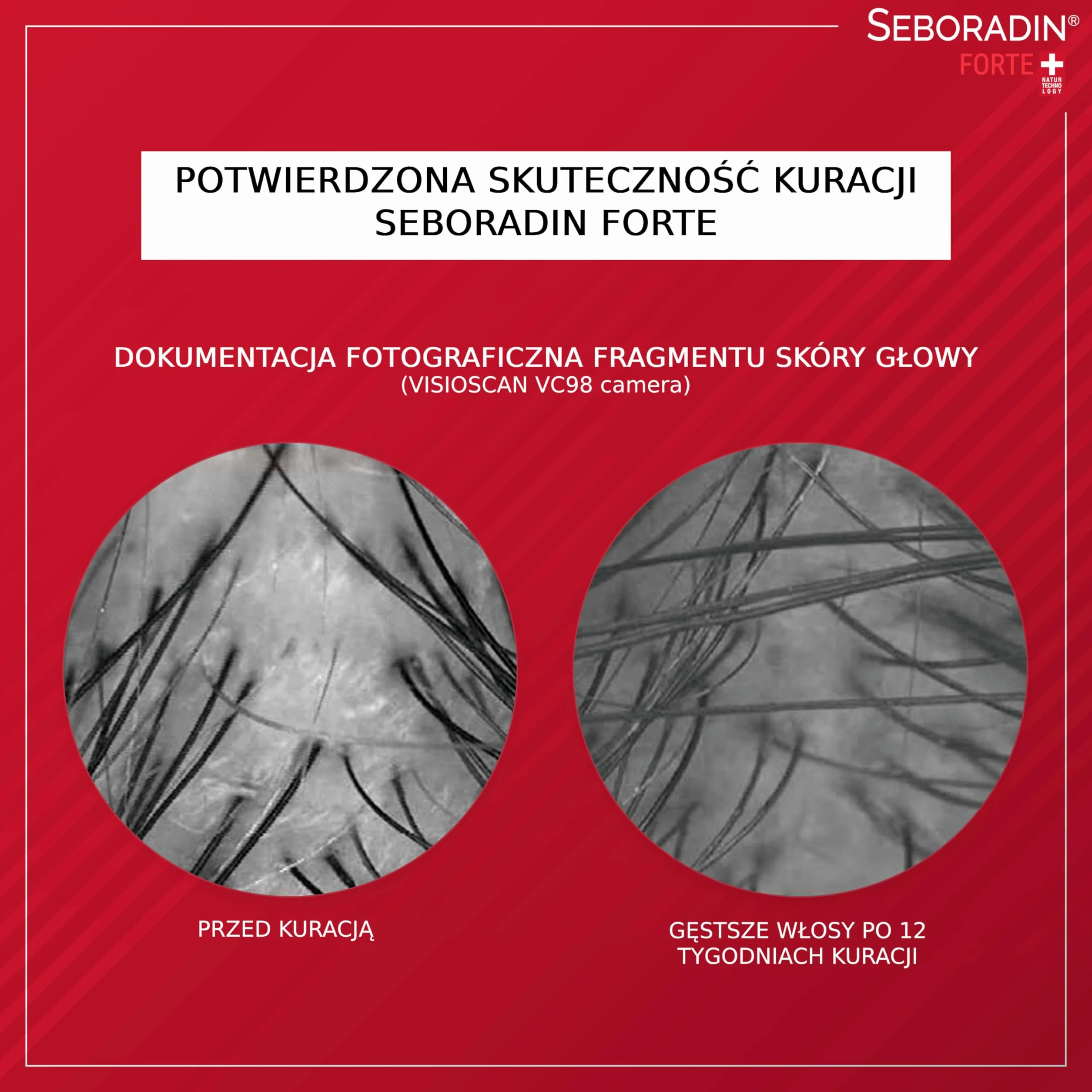 Seboradin Szampon Przeciw Wypadaniu Włosów Z Witaminami I Naturalnymi Ekstraktami Forte 400 ml