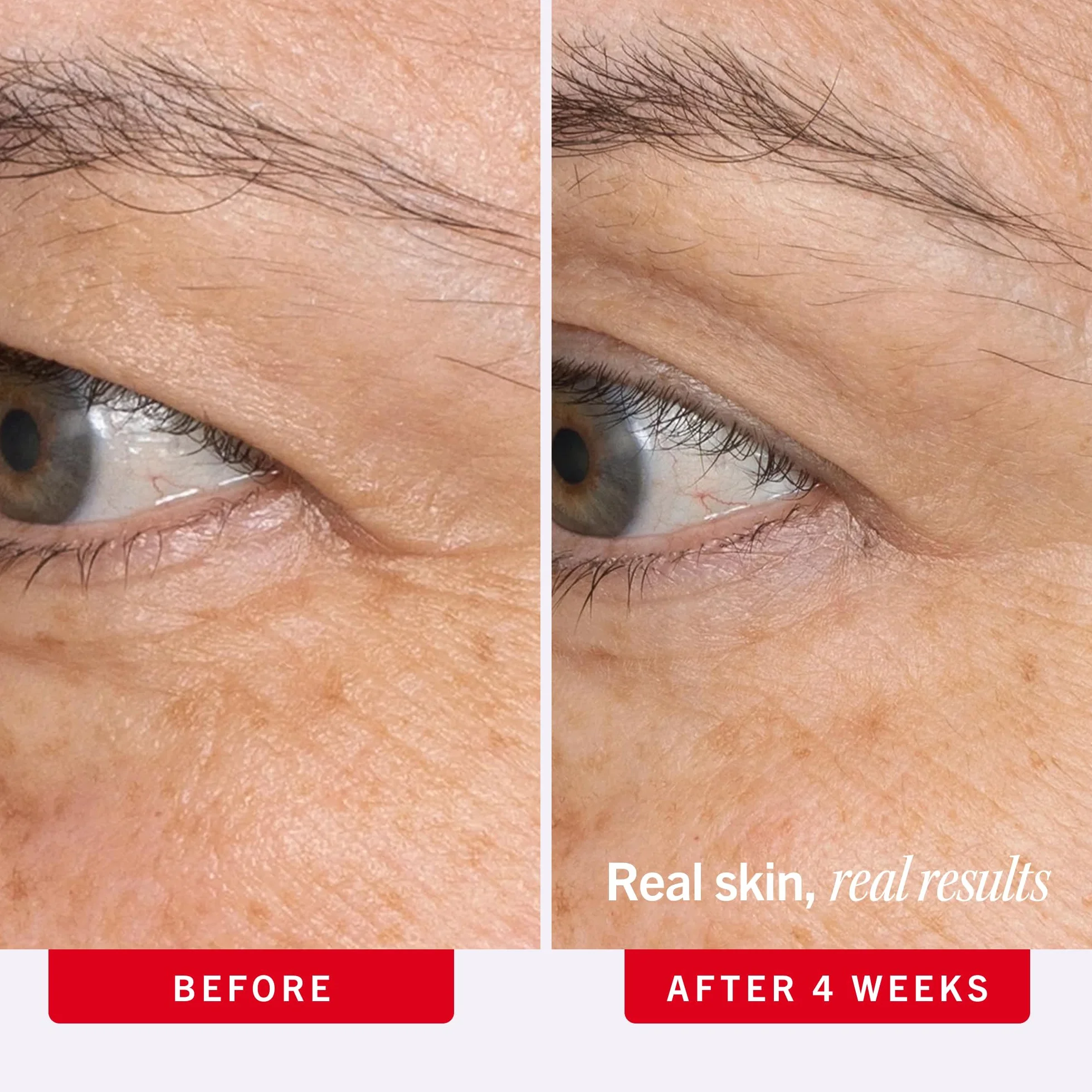 First Aid Beauty - Krem pod oczy z retinolem with skwalanem i ceramidami, serum z kapsułkowanym retinolem do delikatnej skóry, pomaga poprawić wygląd drobnych linii i zmarszczek