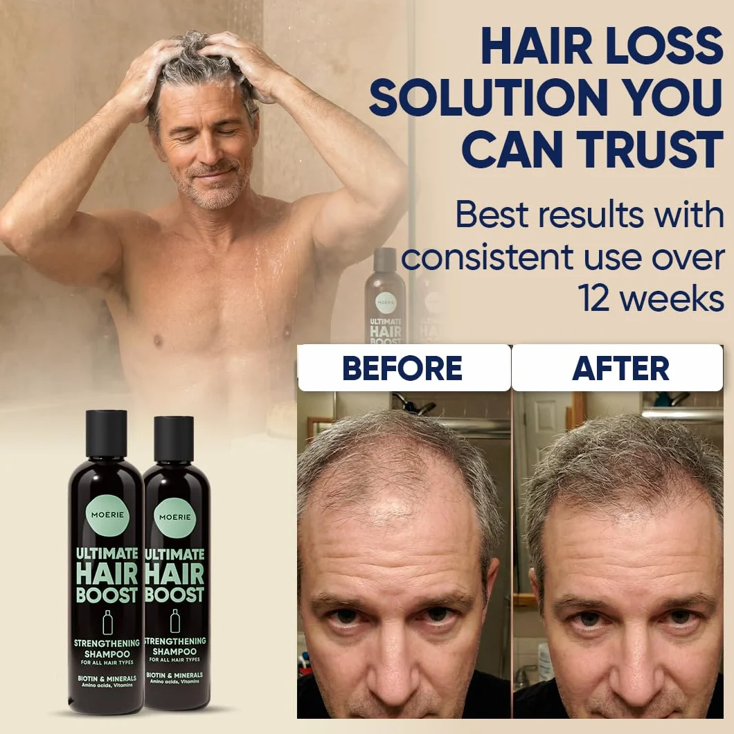Moerie Ultimate Hair Growth Shampoo – dla dłuższych, grubszych, pełnych włosów, wegańskie, bez parabenów i silikonu