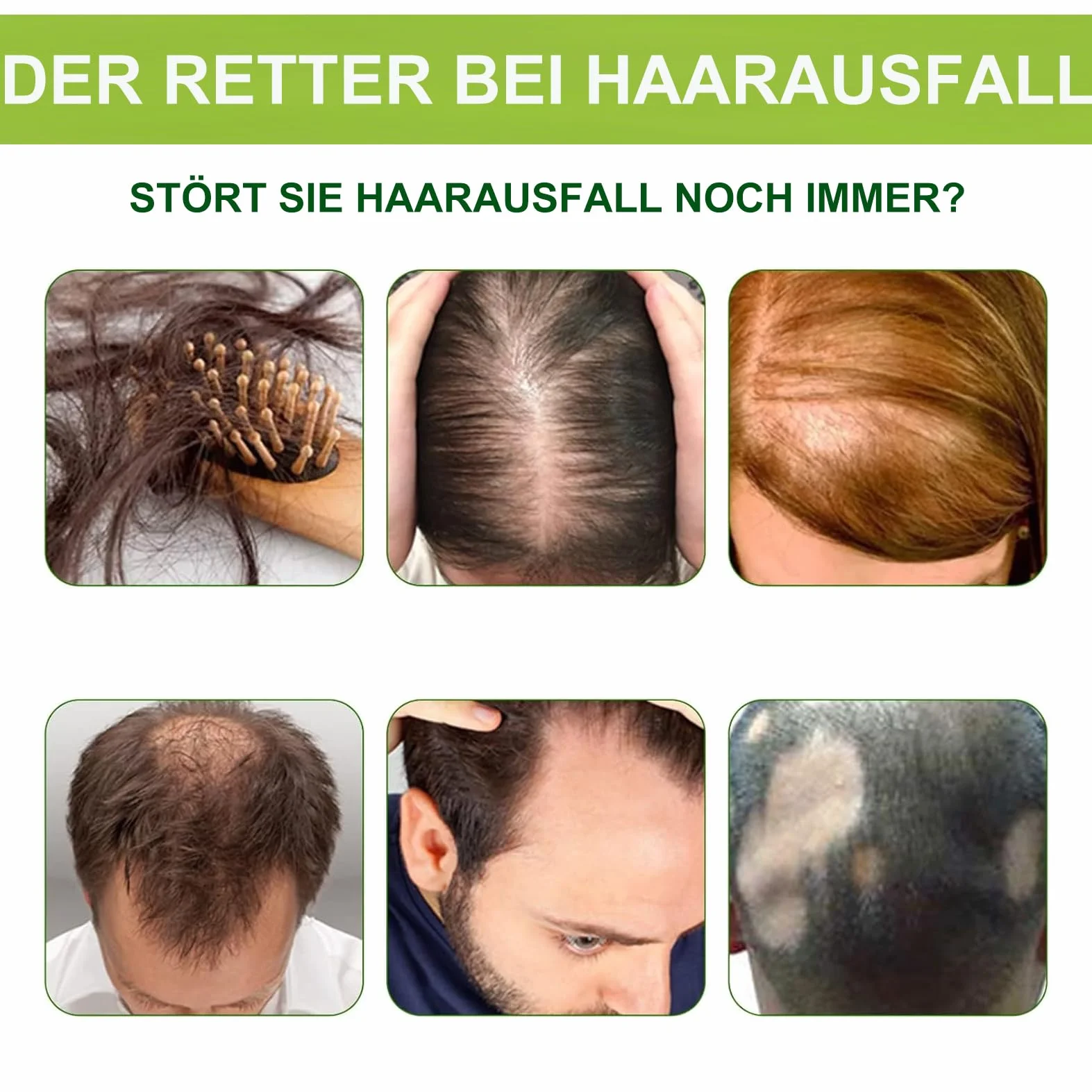 Microneedle Hair Regrowth System – system odrastania włosów, mikroinfuzja serum na wzrost włosów, wzmacnia cebulki włosów, wspomaga wzrost włosów, zapobiega wypadaniu włosów dla mężczyzn i kobiet