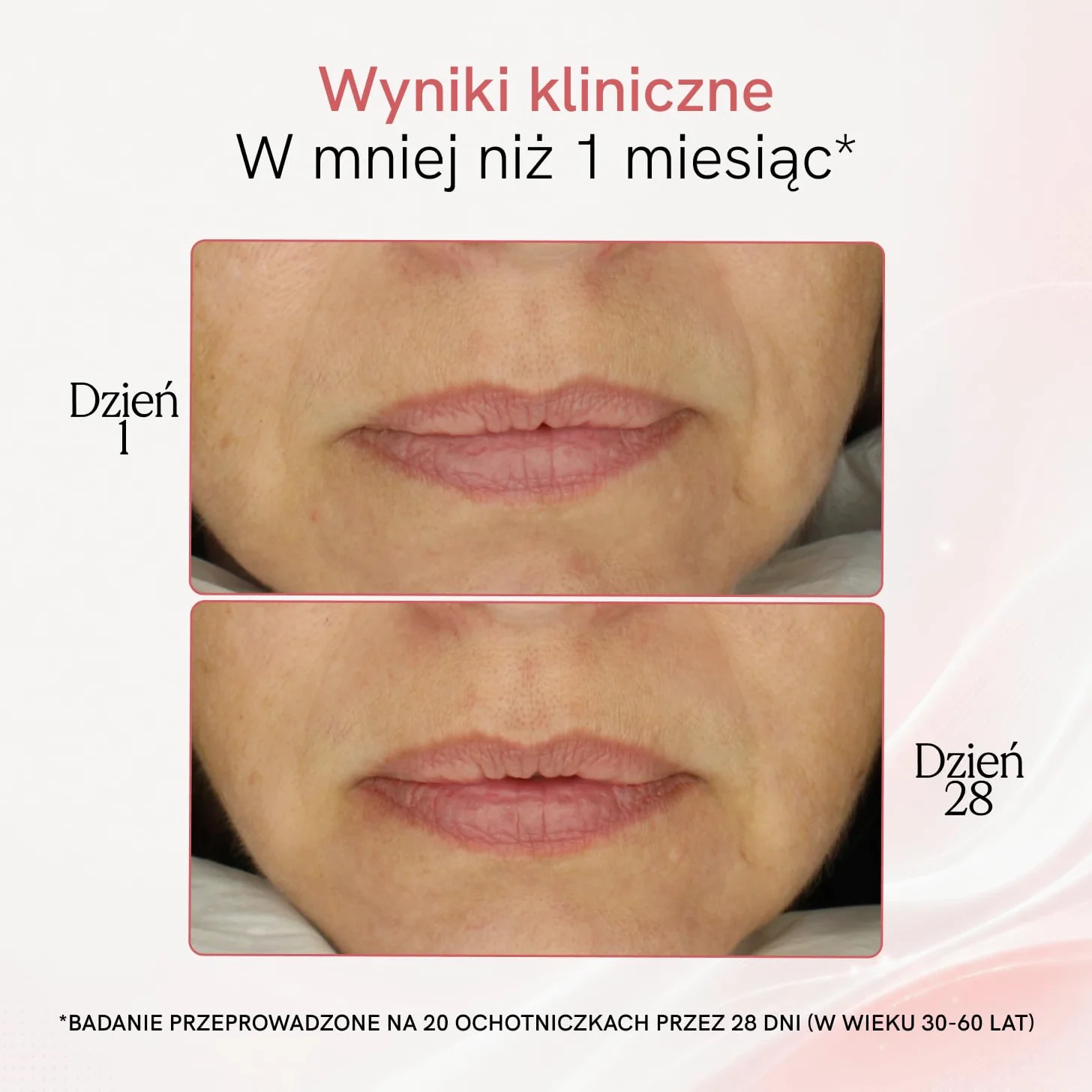 MASDERM | Urządzenie o częstotliwości radiowej twarz 5 w 1 | Elektryczny masażer | Czyszczenie | Profesjonalna maszyna Hifu do twarzy i ciała | Galwanika ujędrniająca