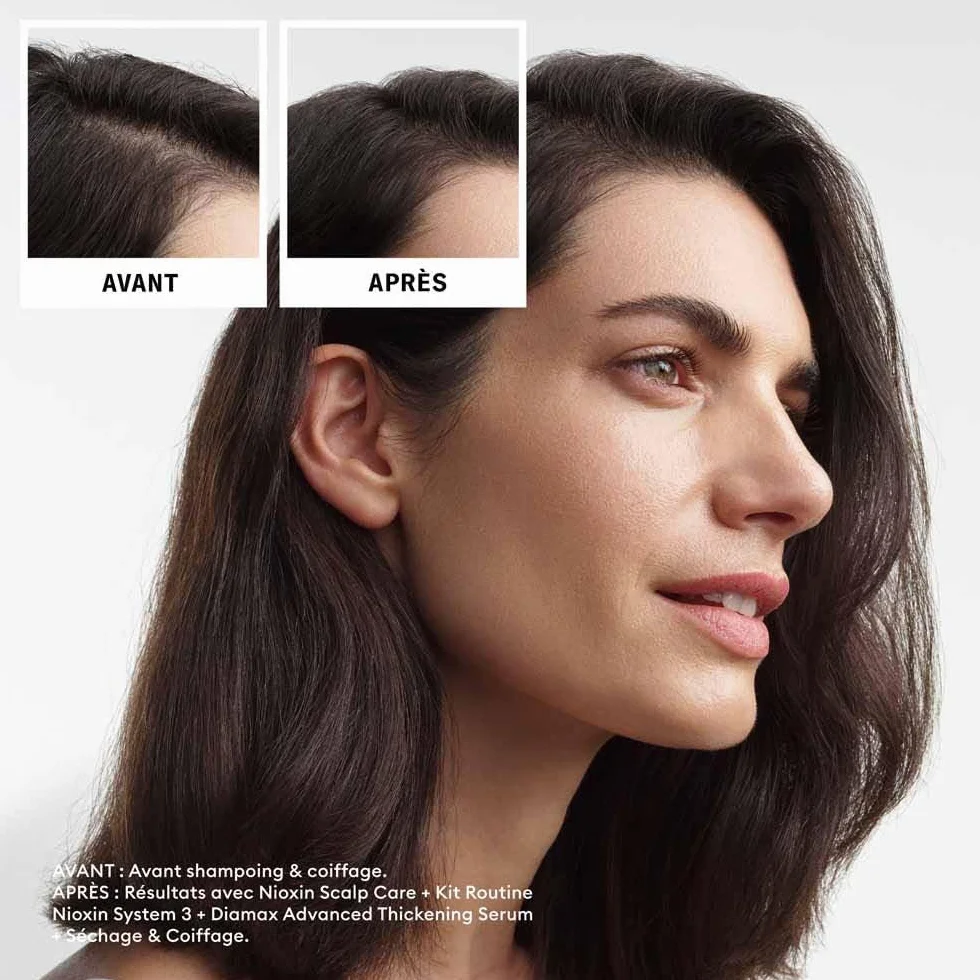 Nioxin System 3 Scalp + Hair Kit szampon odżywka pielęgnacja skóry 300+300+100 ml do włosów farbowanych