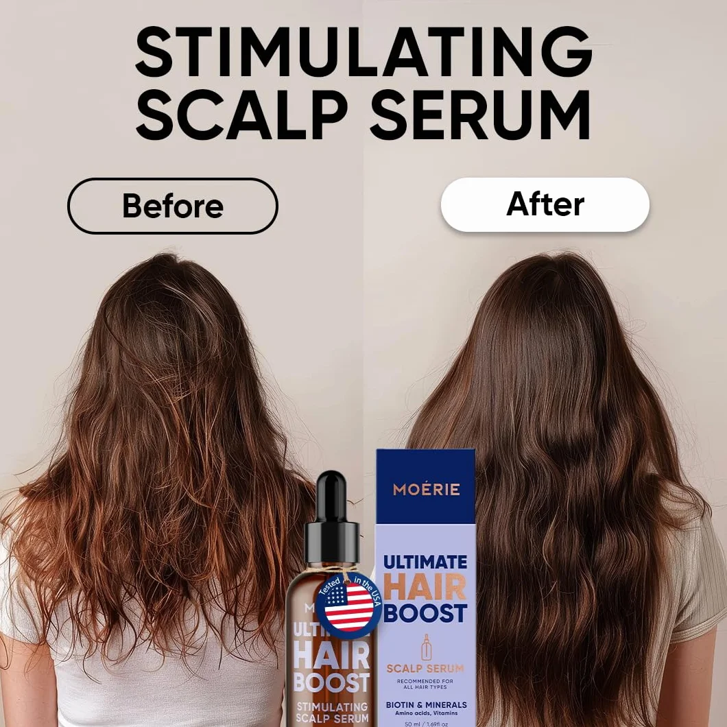 MOERIE Serum do wzrostu i pogrubienia włosów Naturalna alternatywa przeciw wypadaniu i uszlachetnianiu włosów - 50 ml