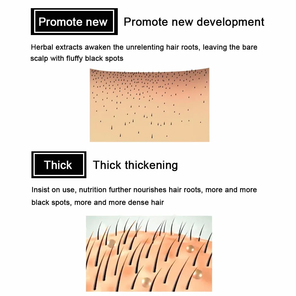 Serum na porost włosów z imbirem, Hair Growth Treatment dla kobiet i mężczyzn (2 sztuki)